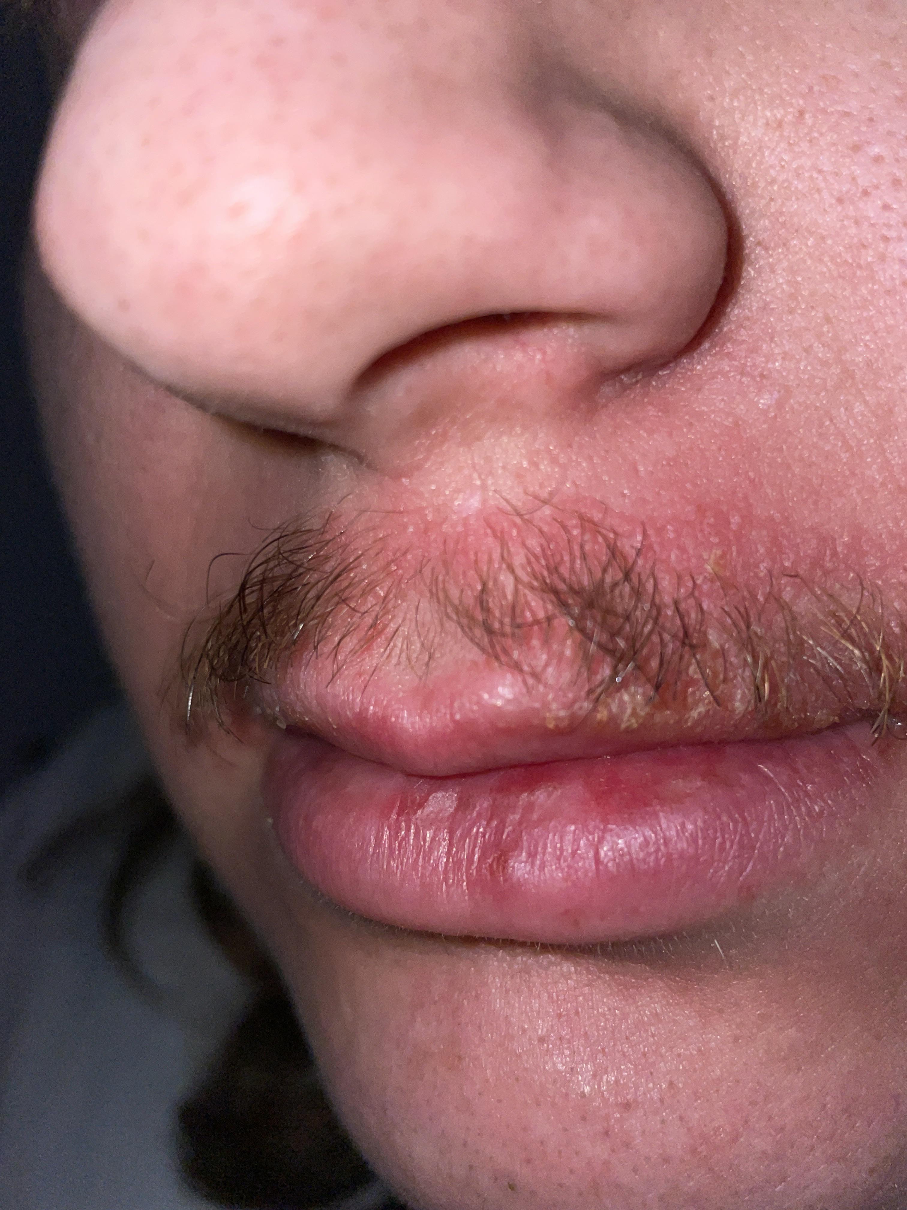 [skin concern] bf used just for men facial hair dye, feels itchy and