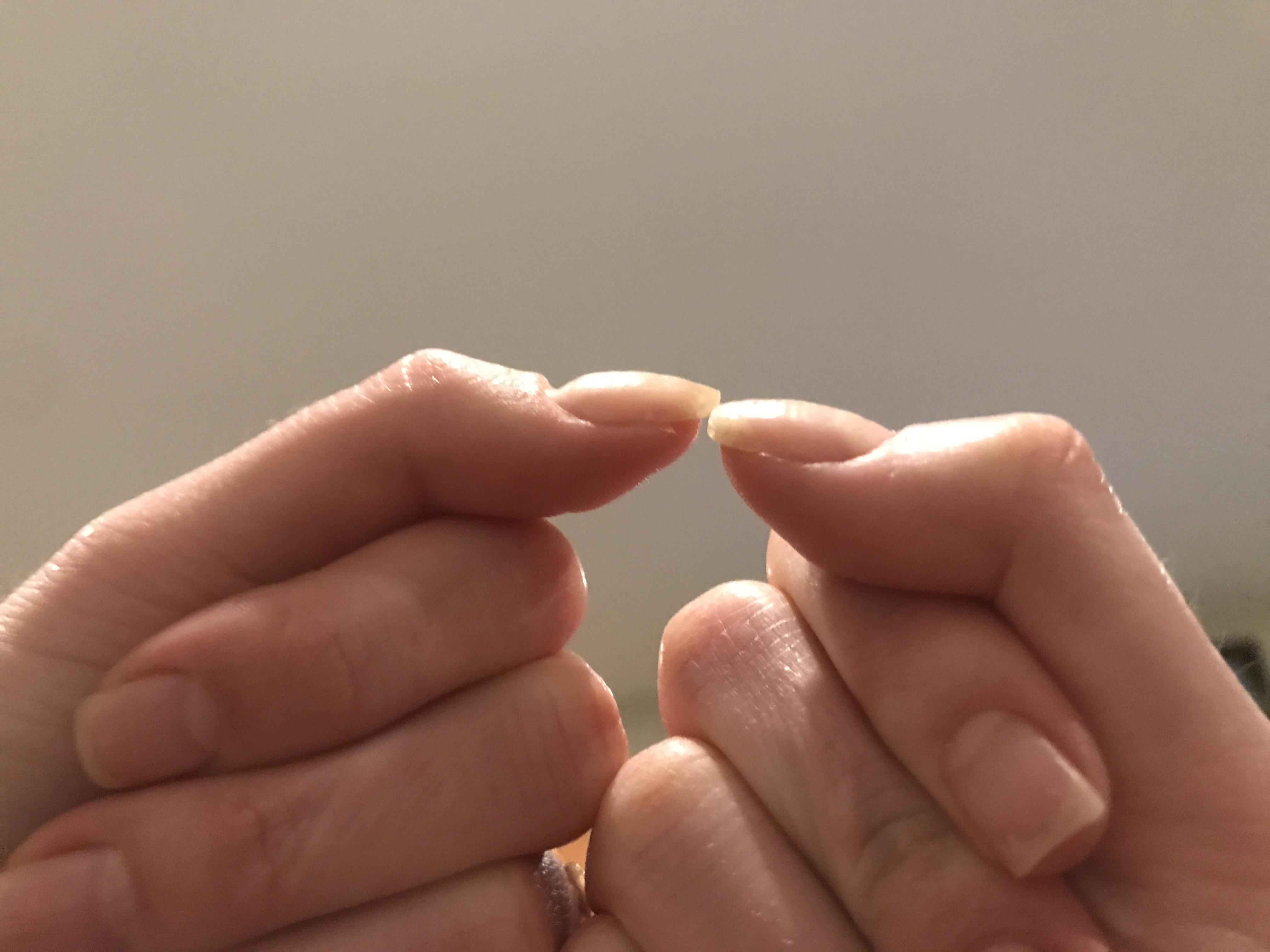 I hit my left thumb in just a spot that my nail is growing out with a