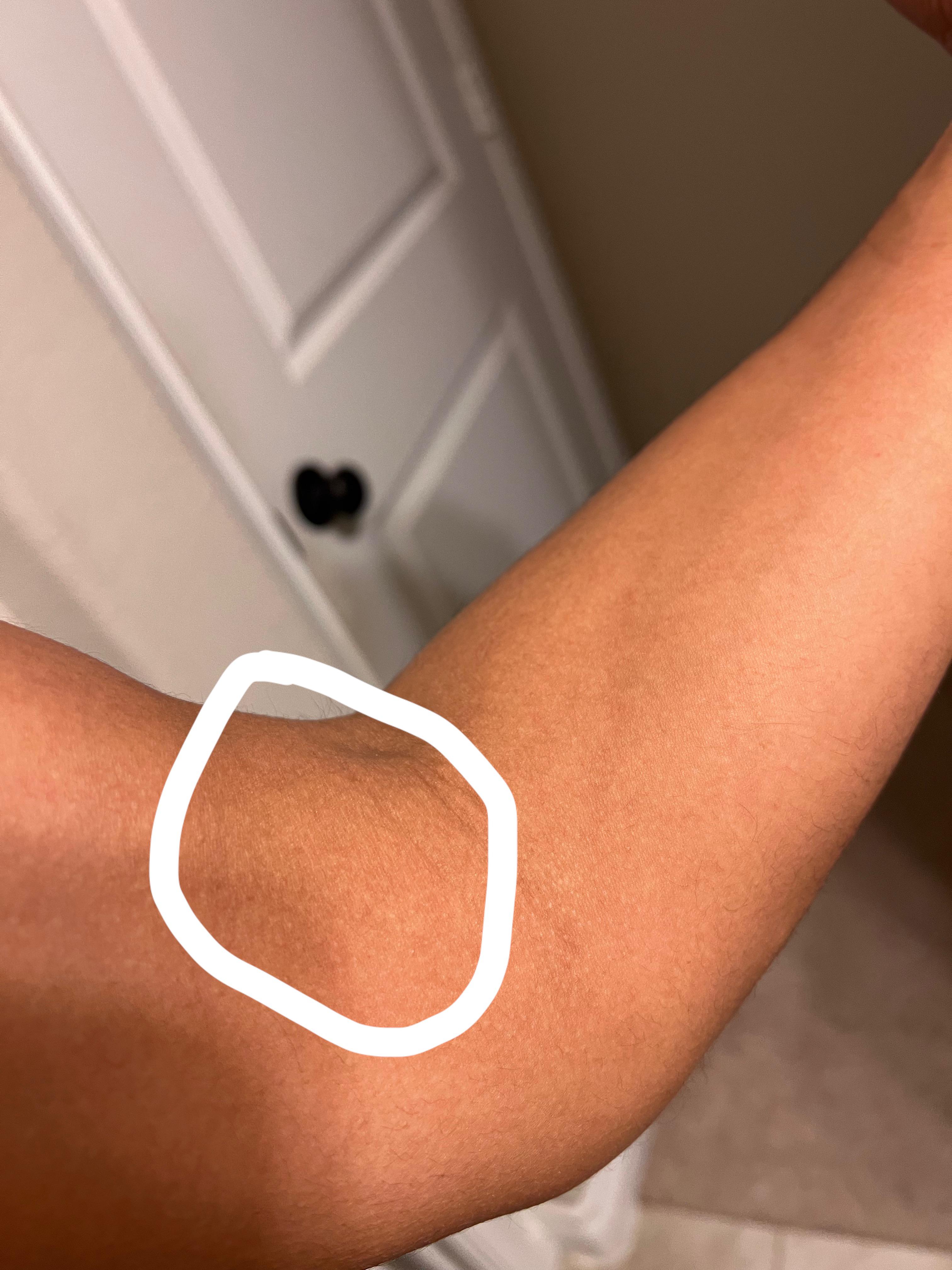 For some reason when I try to flex my biceps on one arm I don’t feel my