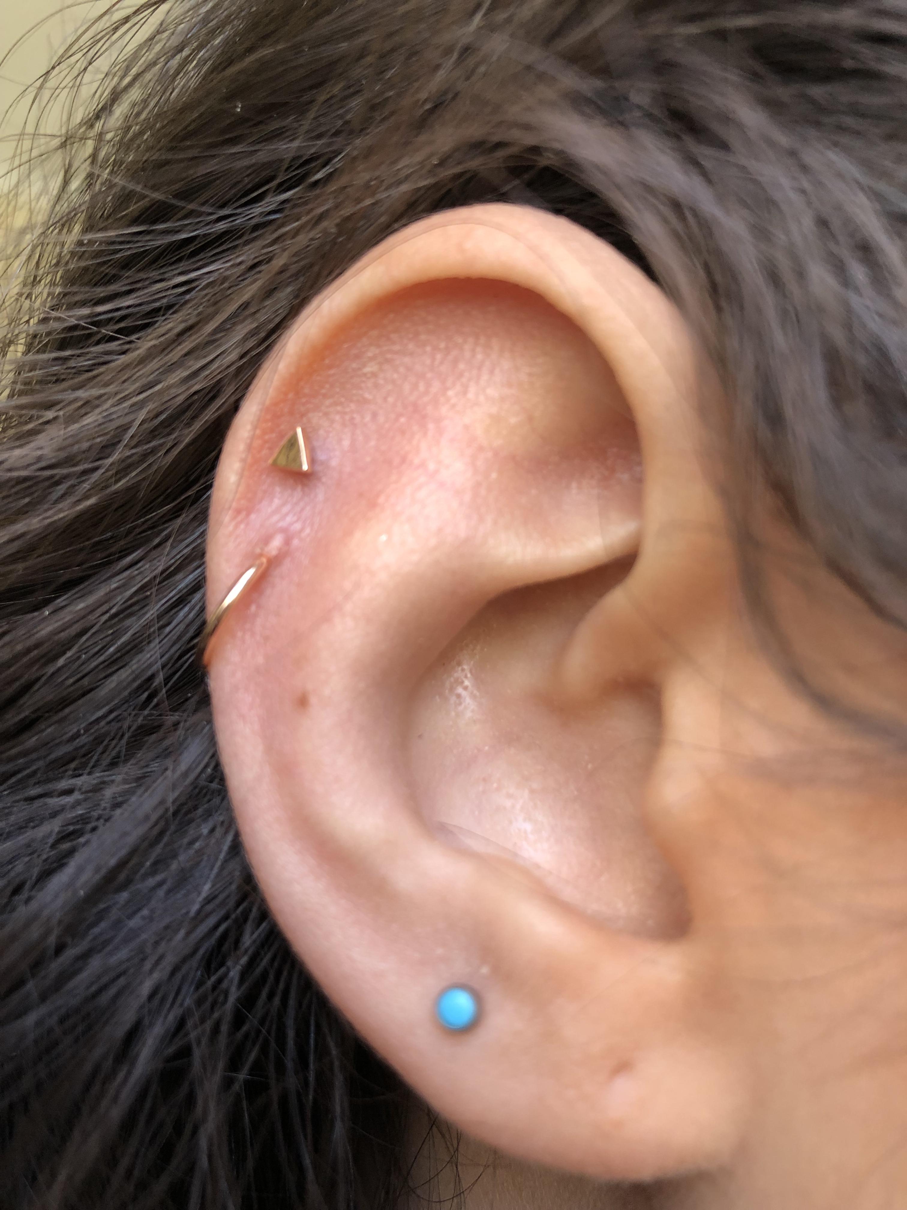 Help! A small bump popped up on my month old helix piercing. How can I