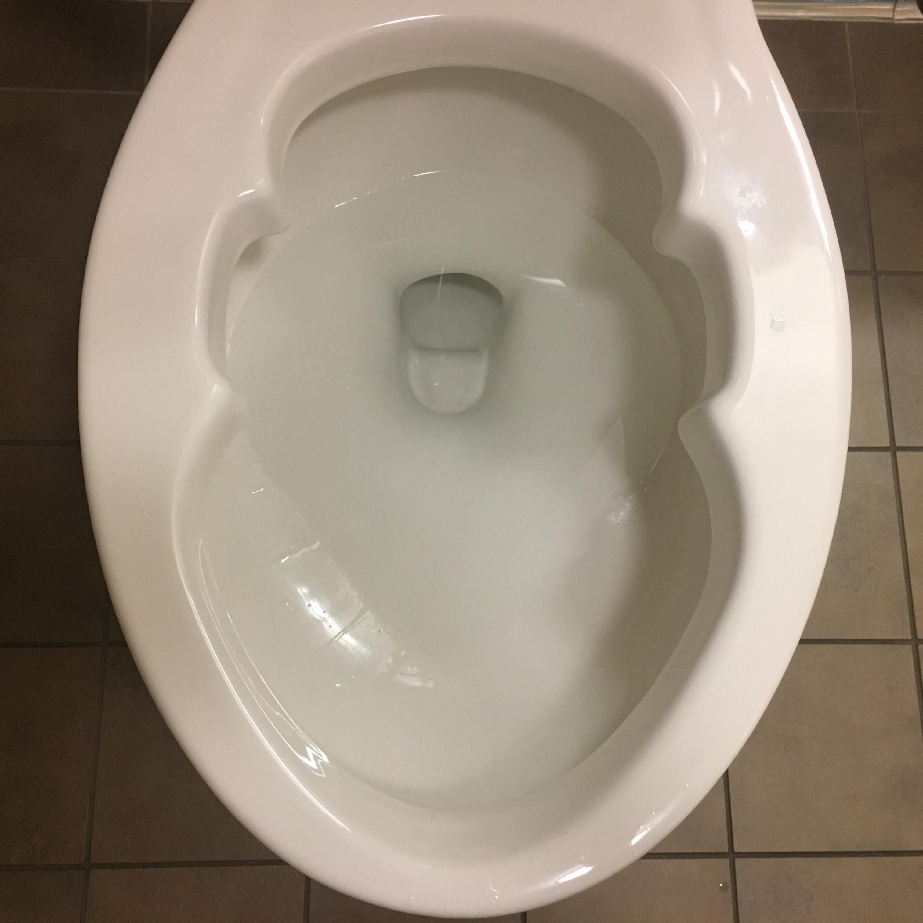 What is the purpose of this hospital toilet’s strange shape? r