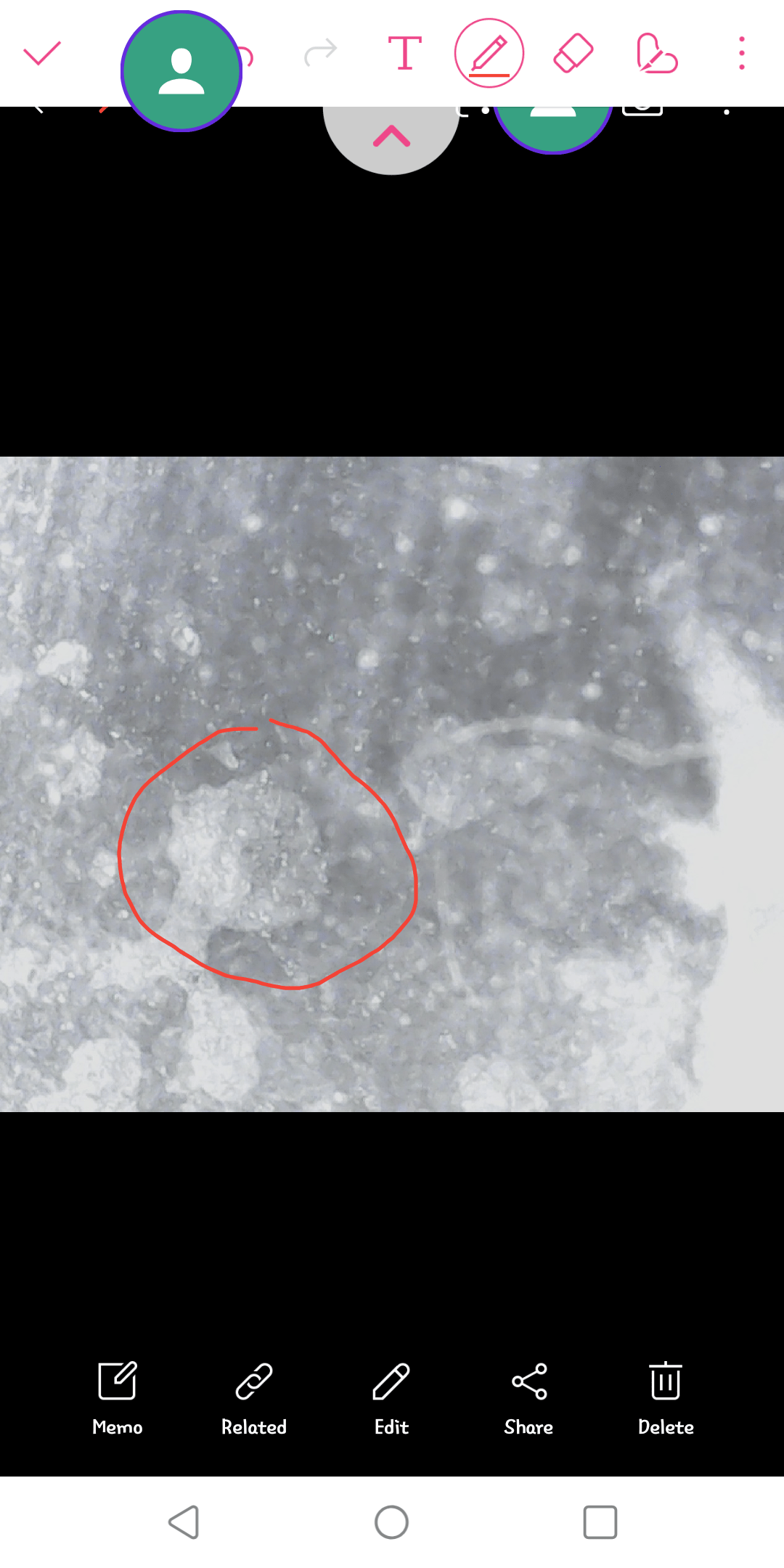 Does Scabies Die In Heat at Numbers Spires blog