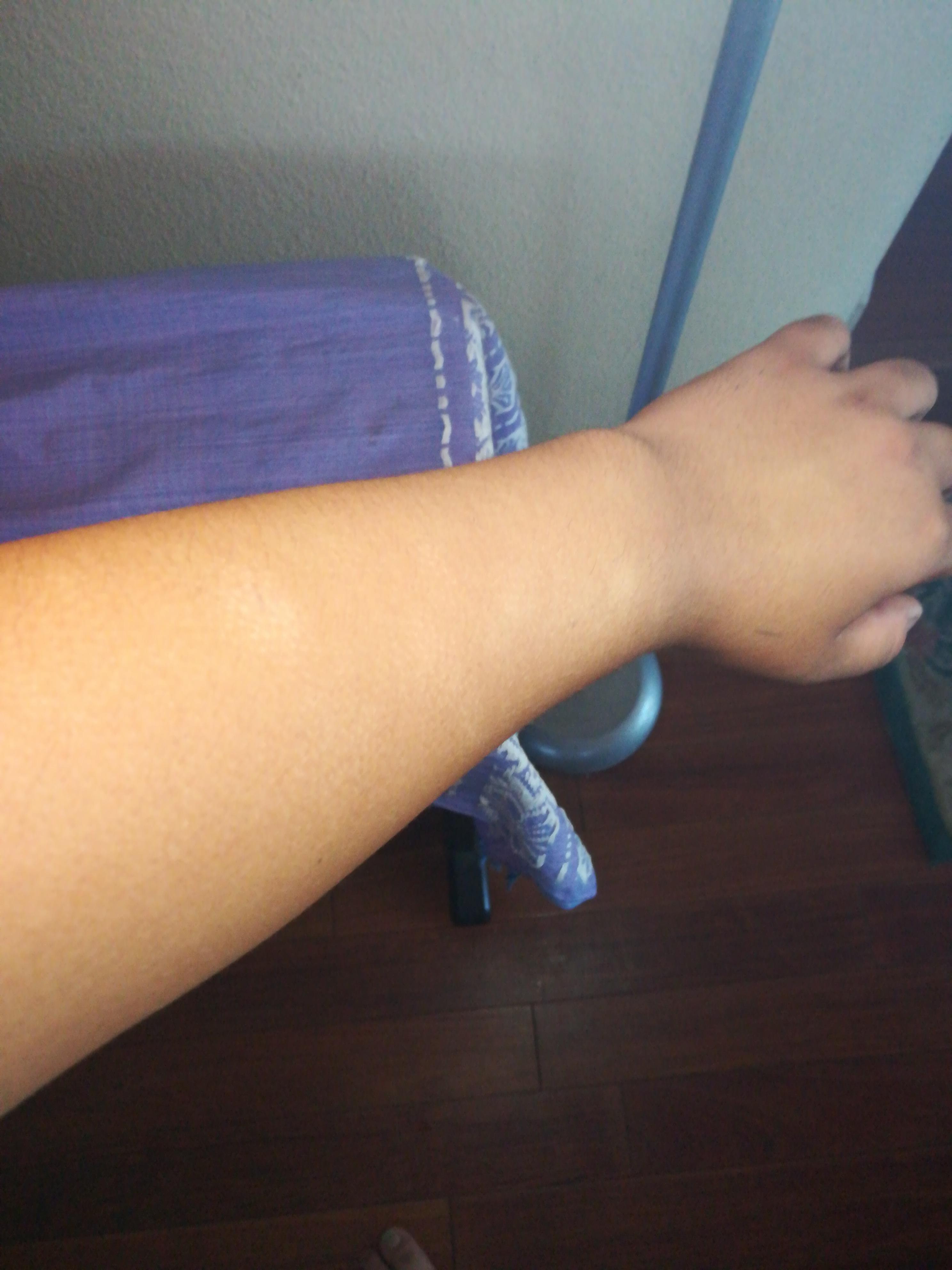 white spots on skin r/Health