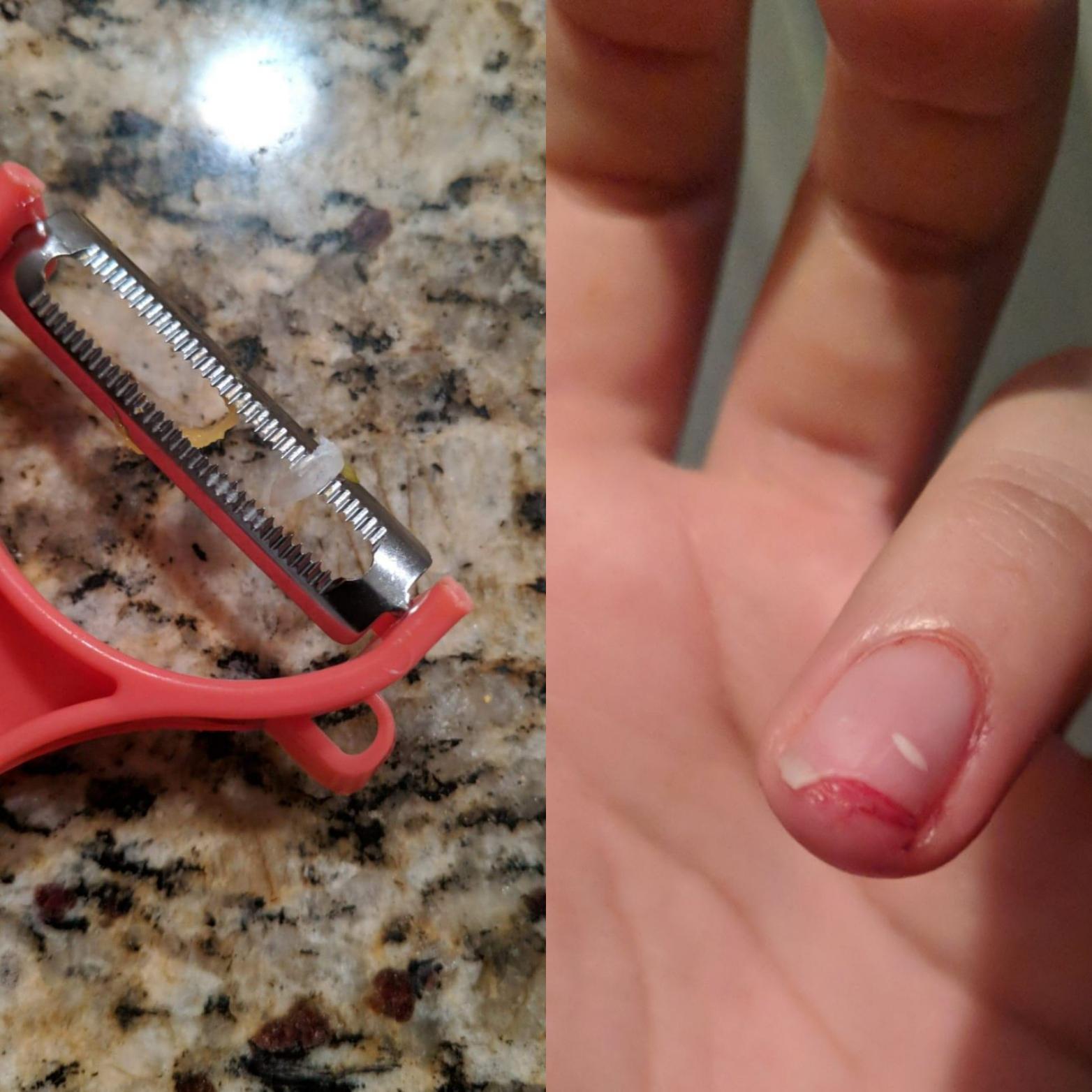 I peeled part of my fingernail off with a veggie peeler r/MakeMeSuffer
