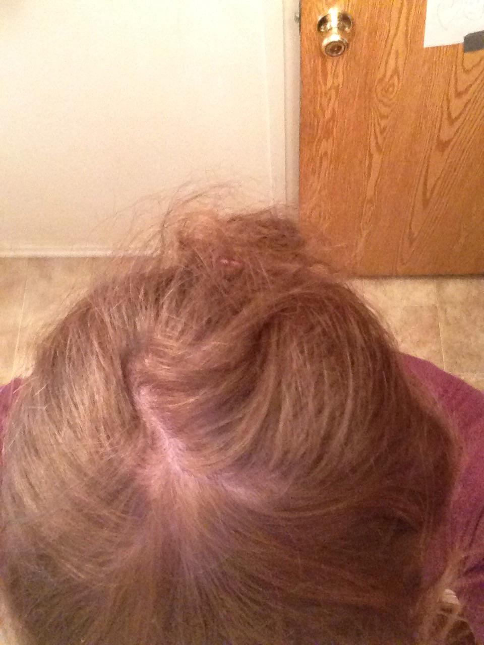 Am I paranoid or is my hairline receding? Or is it just the way my hair