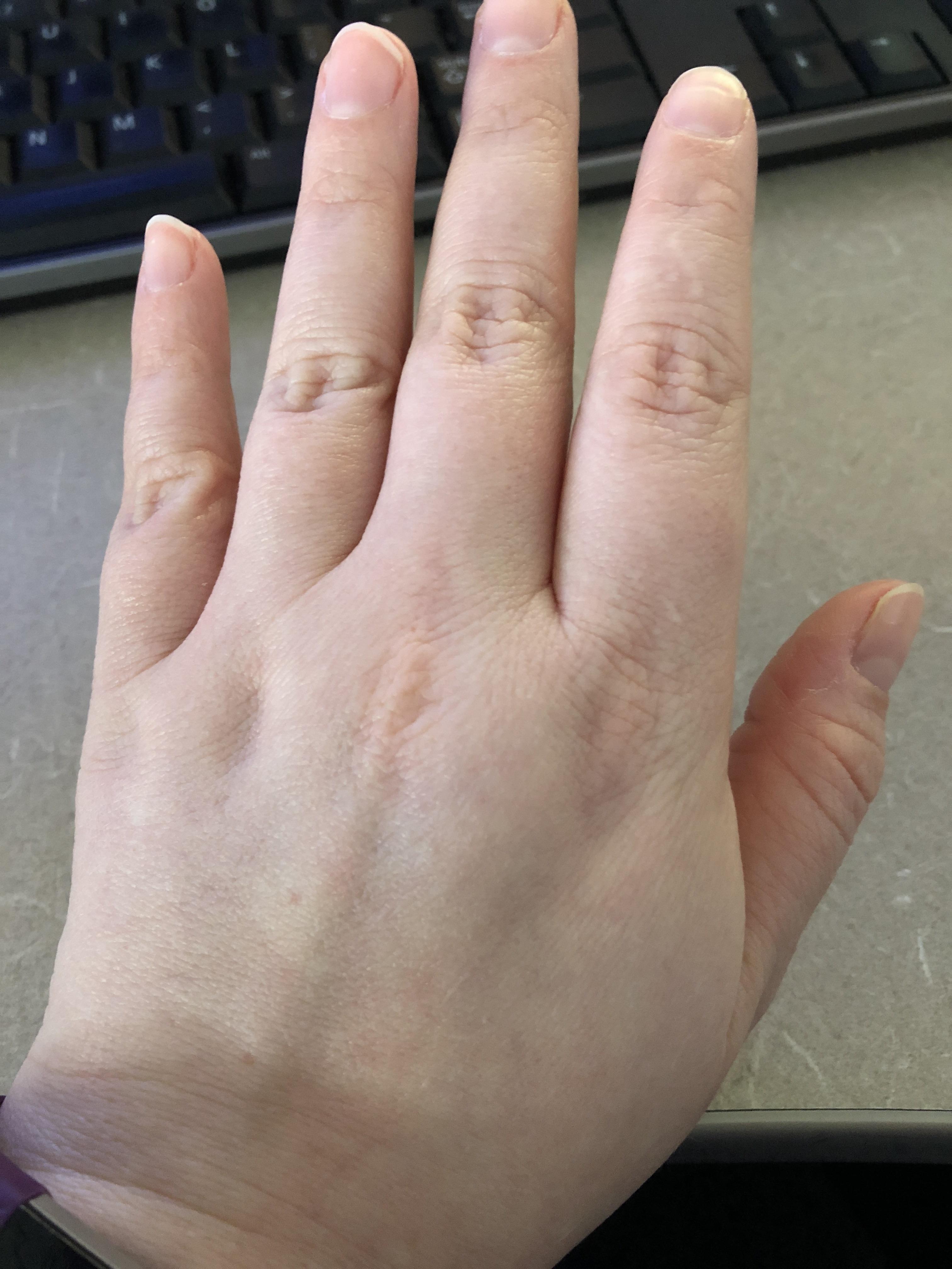 Most flattering styles for plump short fingers? r/EngagementRings