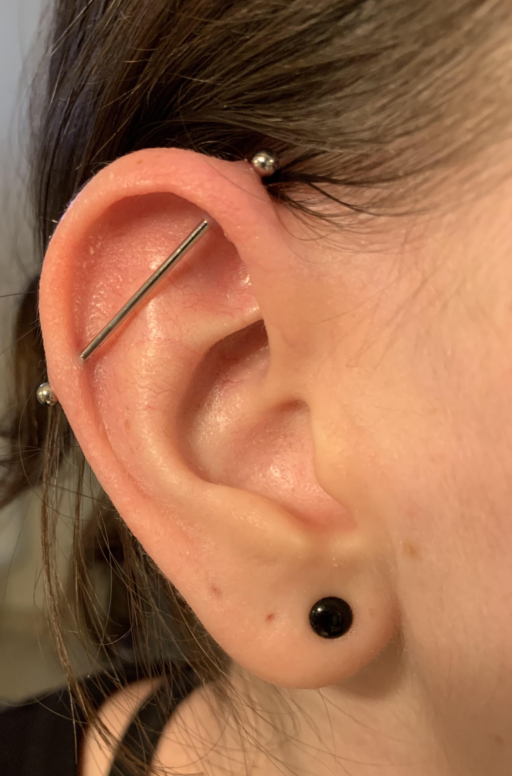 My industrial piercing is developing a bump. Please see details in