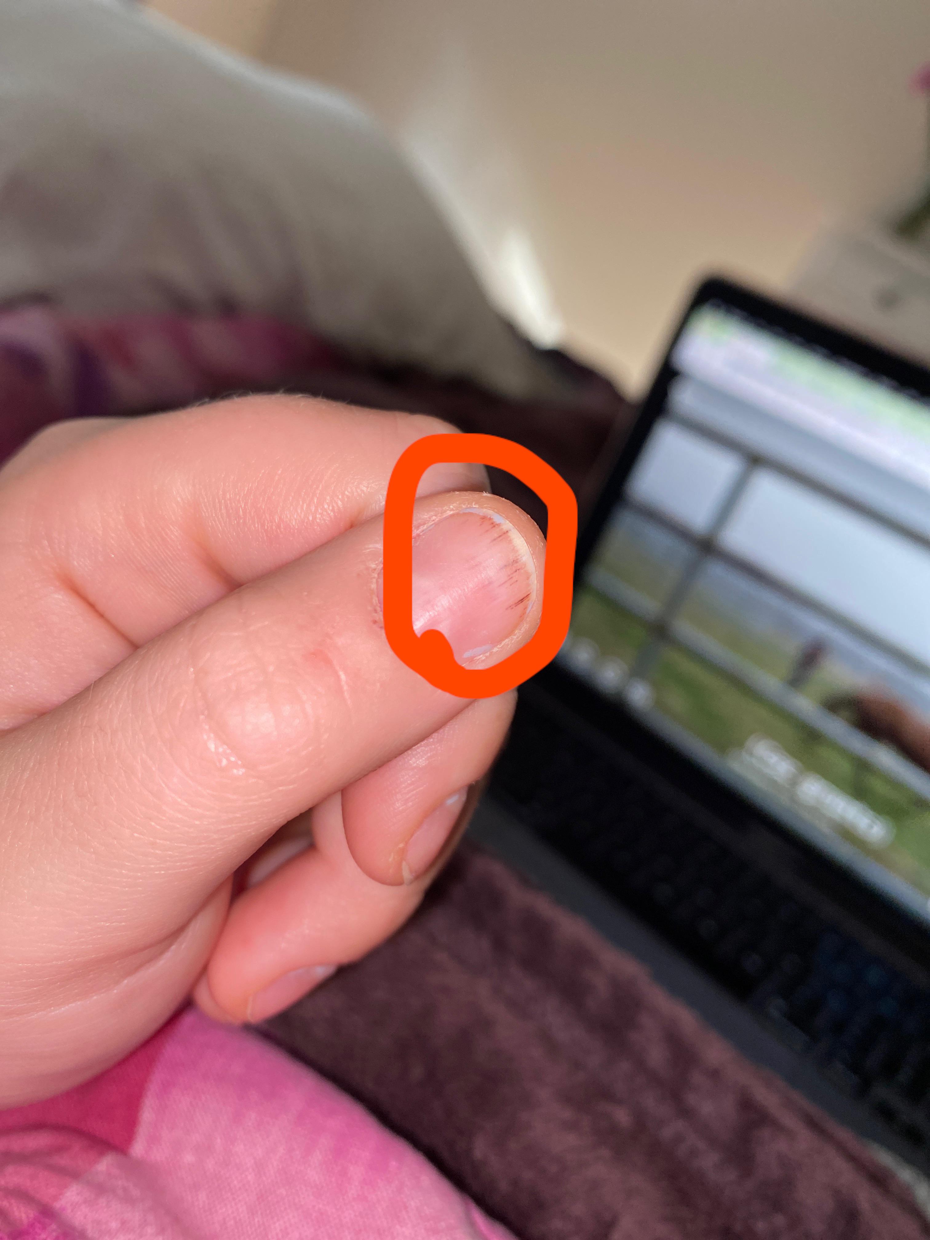 Help please, I found these black lines on my nail and they haven’t gone