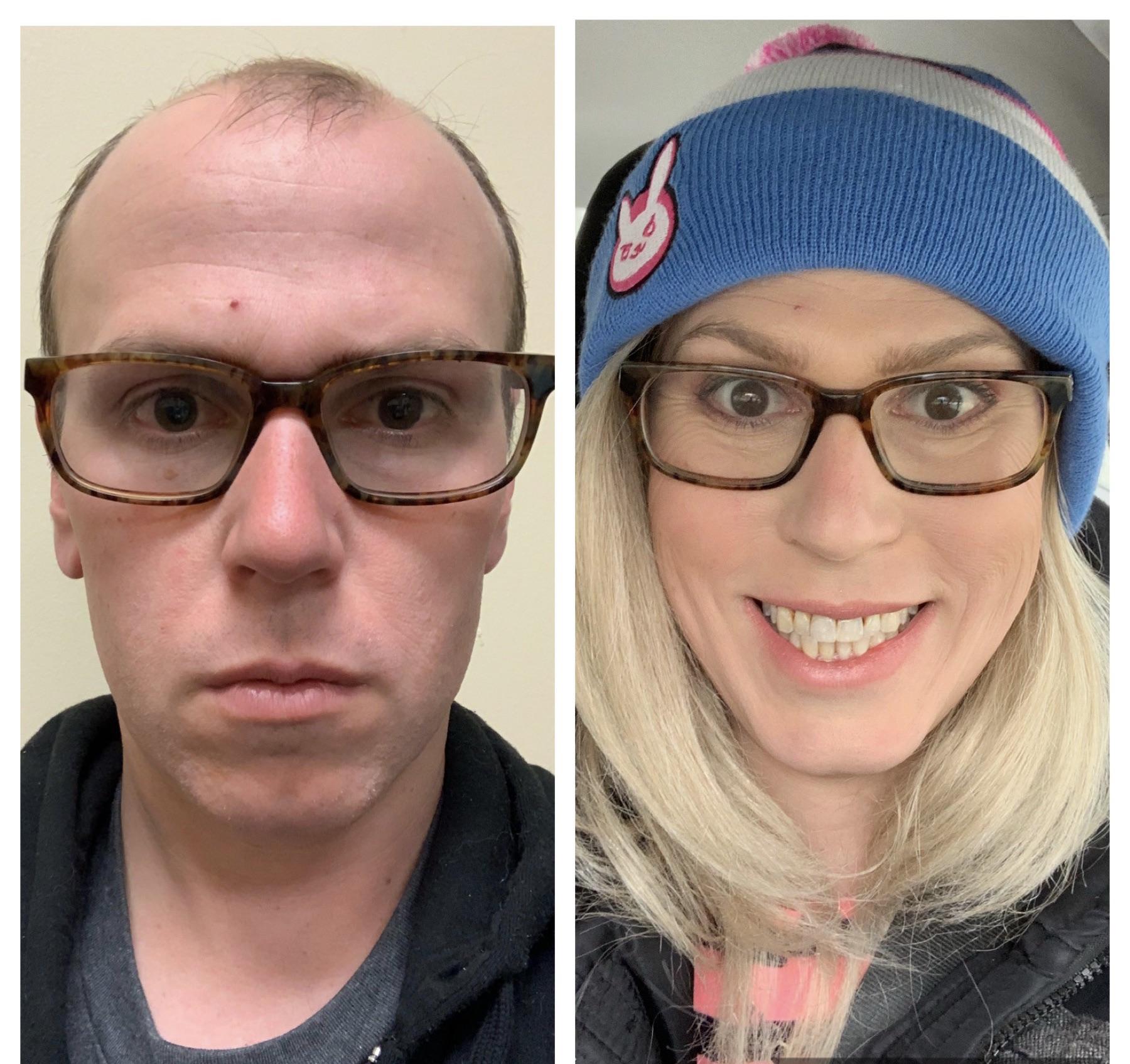 I got misgendered today, so this is a yesterday picture. 0 months vs 9