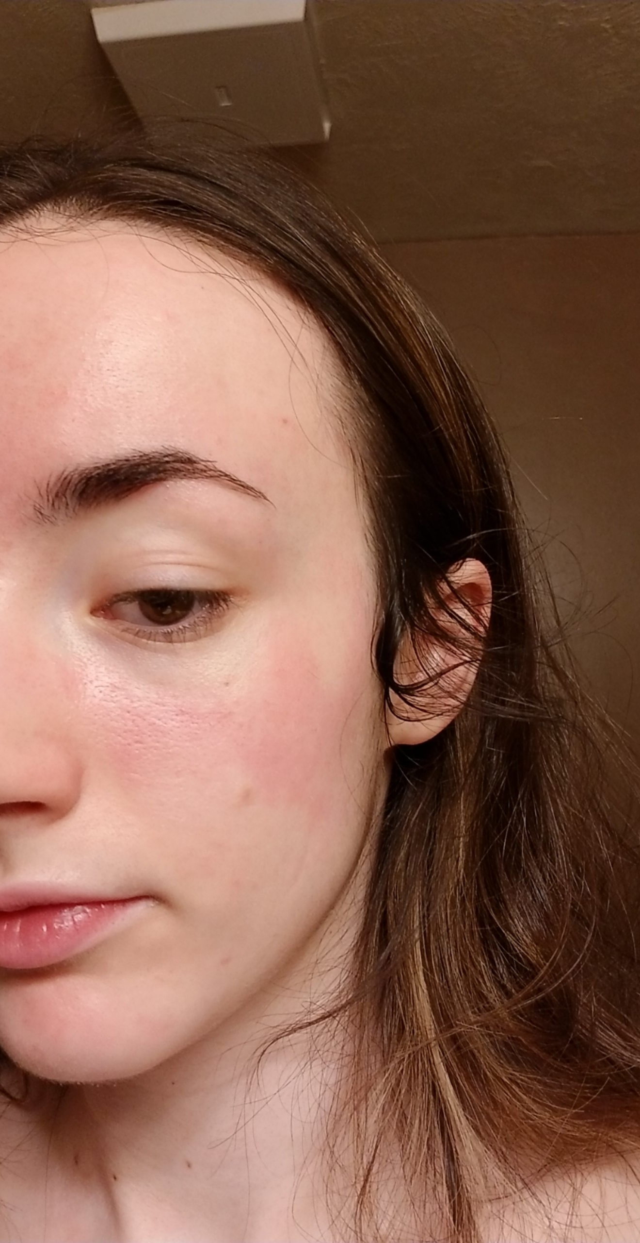 [Skin Concerns] Bad Hyaluronic Acid reaction or something else? r/SkincareAddiction