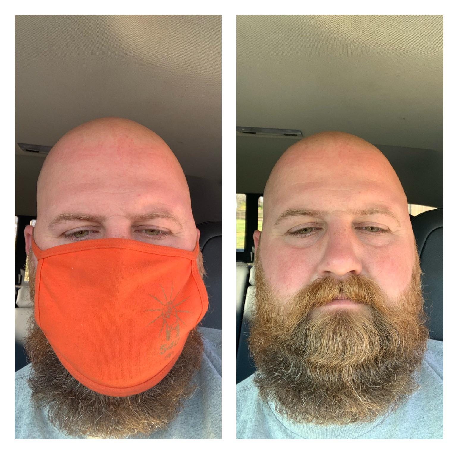 Anyone else get a curve in their beard from their mask? r/beards