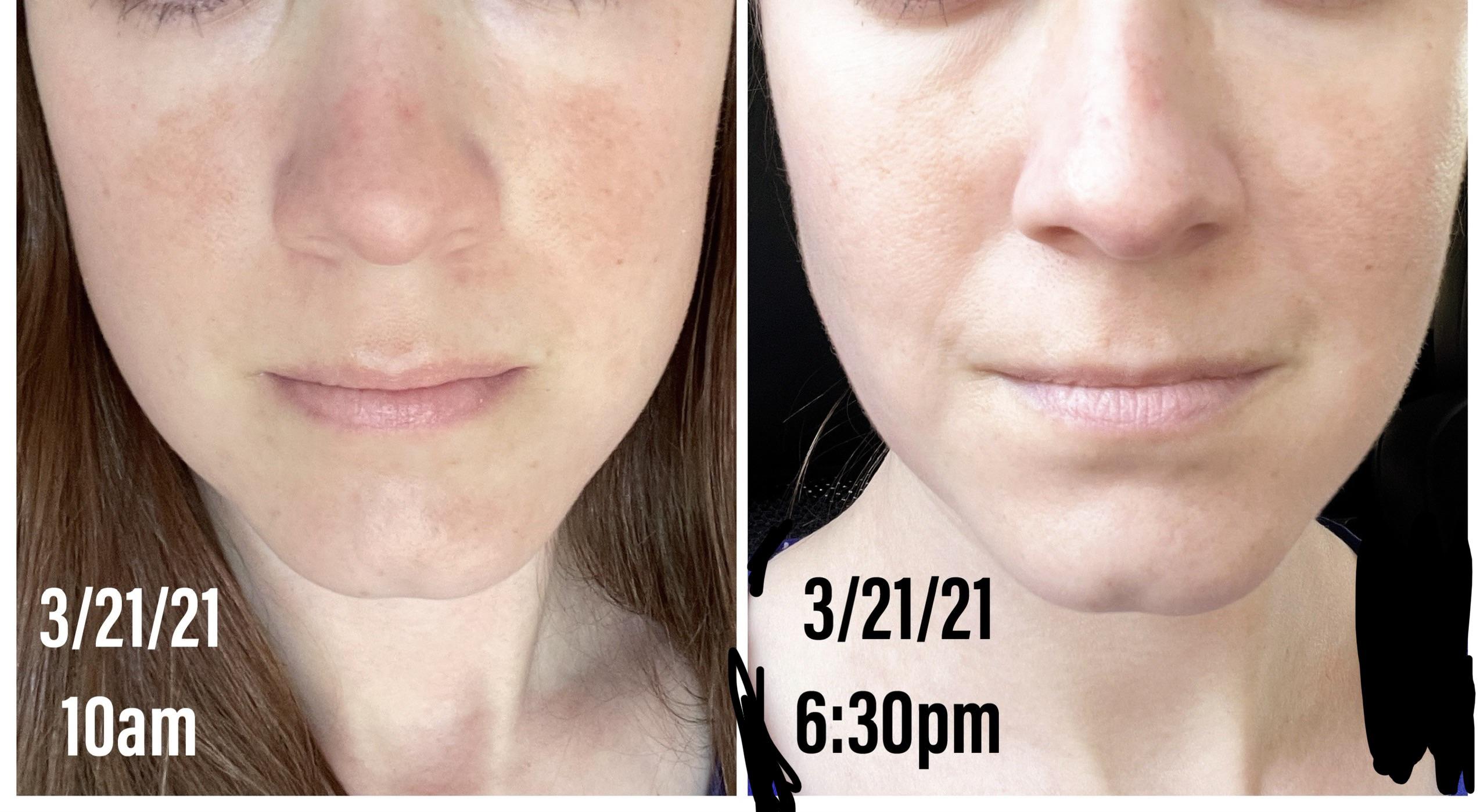 What working in 15 humidity does to my skin daily. Before work vs