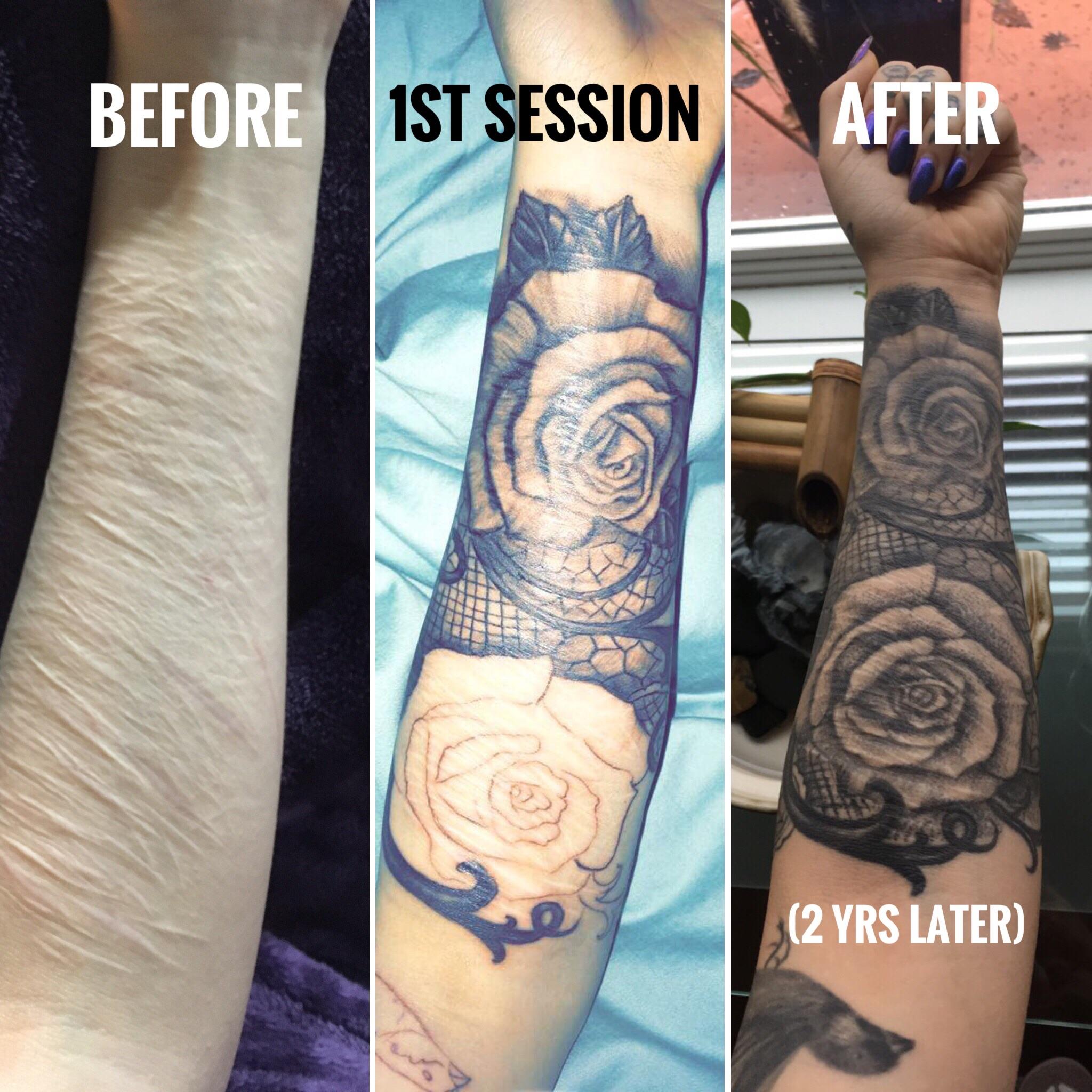 [Get 42+] Self Harm Tattoo Cover Up Reddit Formal Long Dress