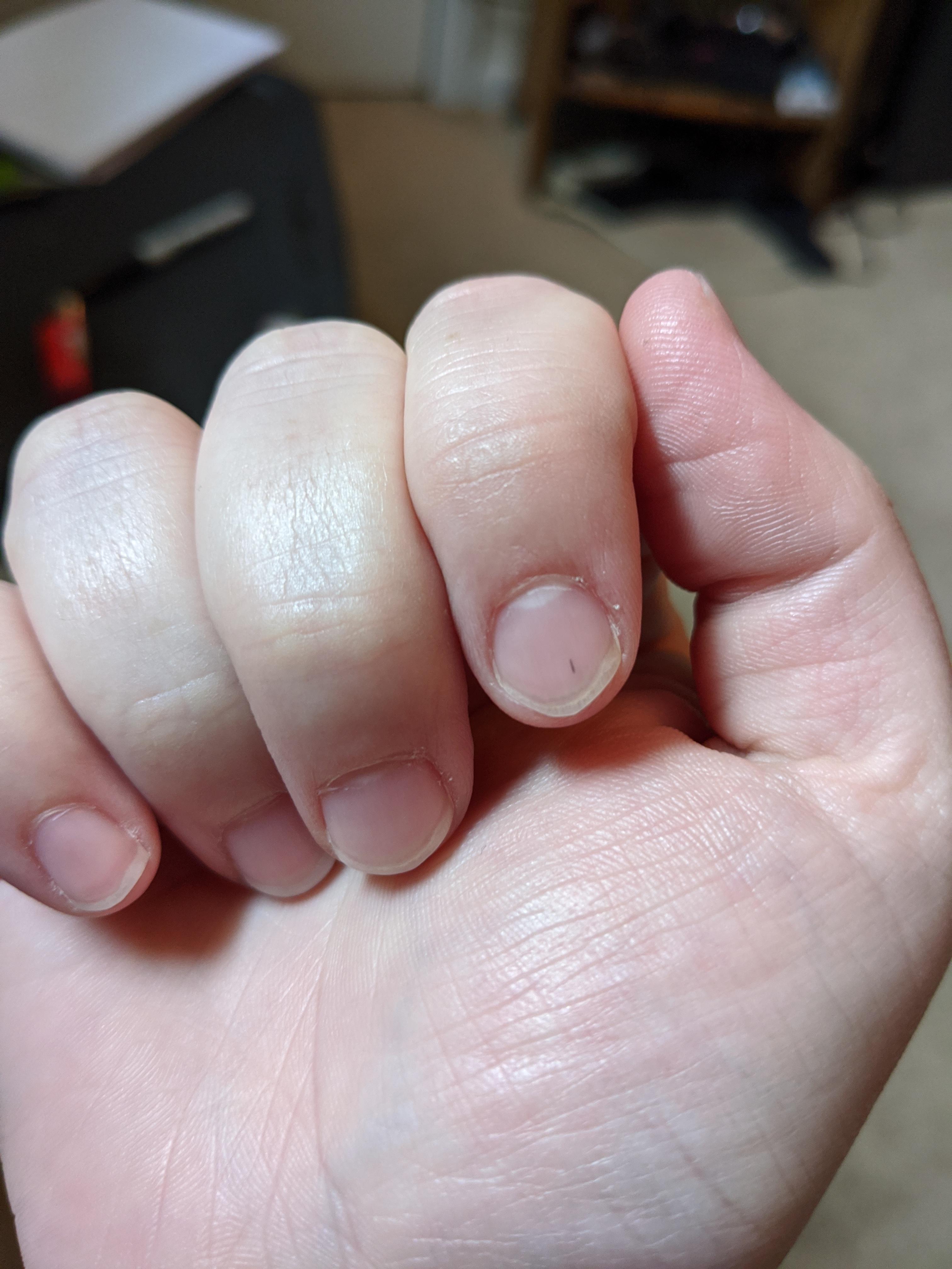 Noticed this black line on my bail a few weeks ago. Hasn't gone away