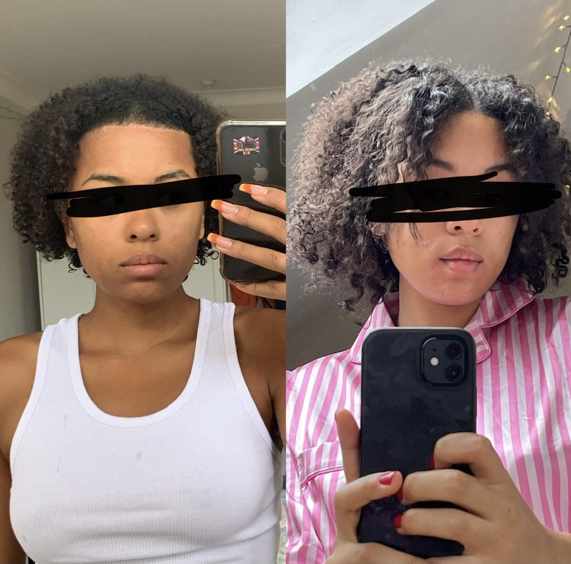 4A HAIR ADVICE PLEASE I HAVE NO CLUE WHAT IM DOING PLEASE UPVOTE