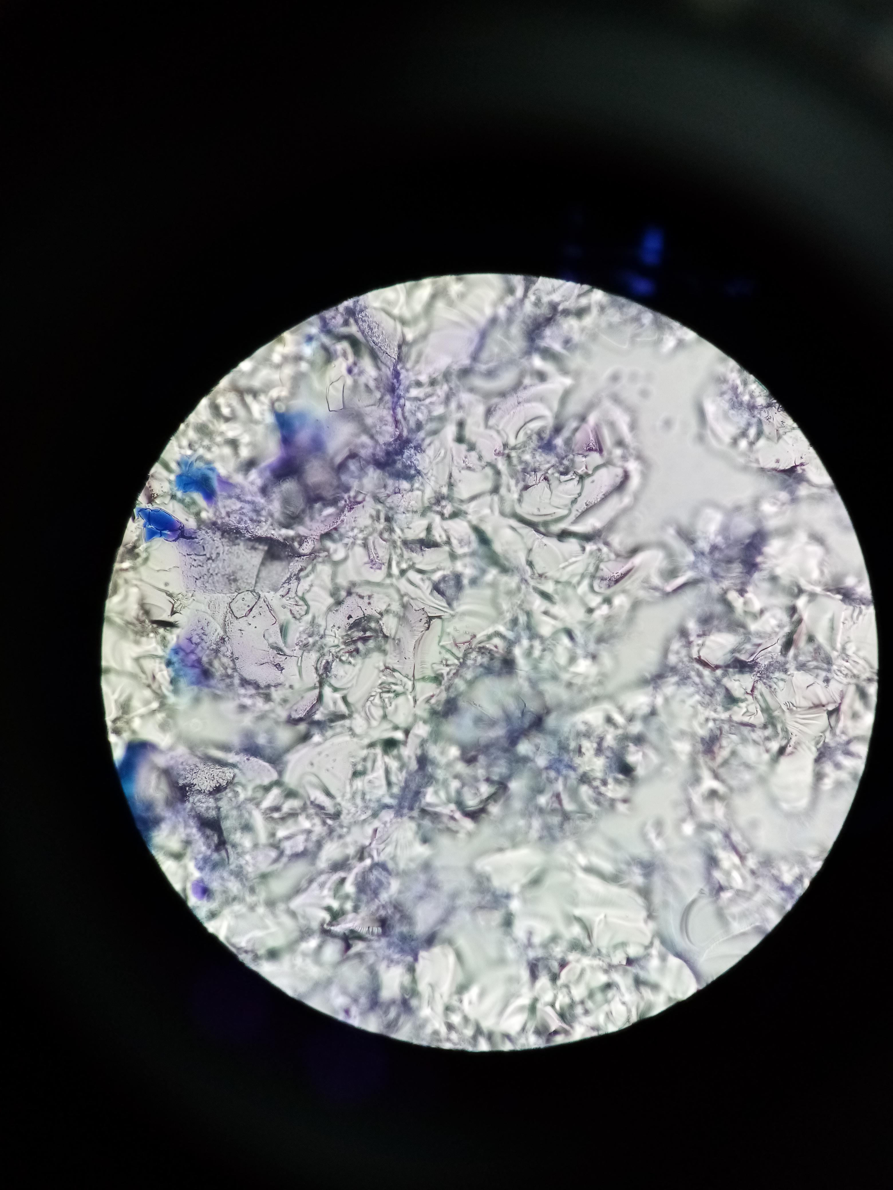 Frosted glass under a microscope. r/mildlyinteresting