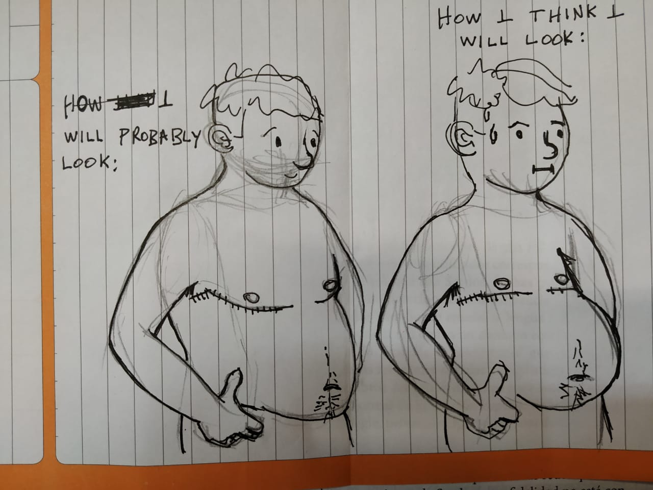 Preop dudes ever felt like this would be the of top surgery