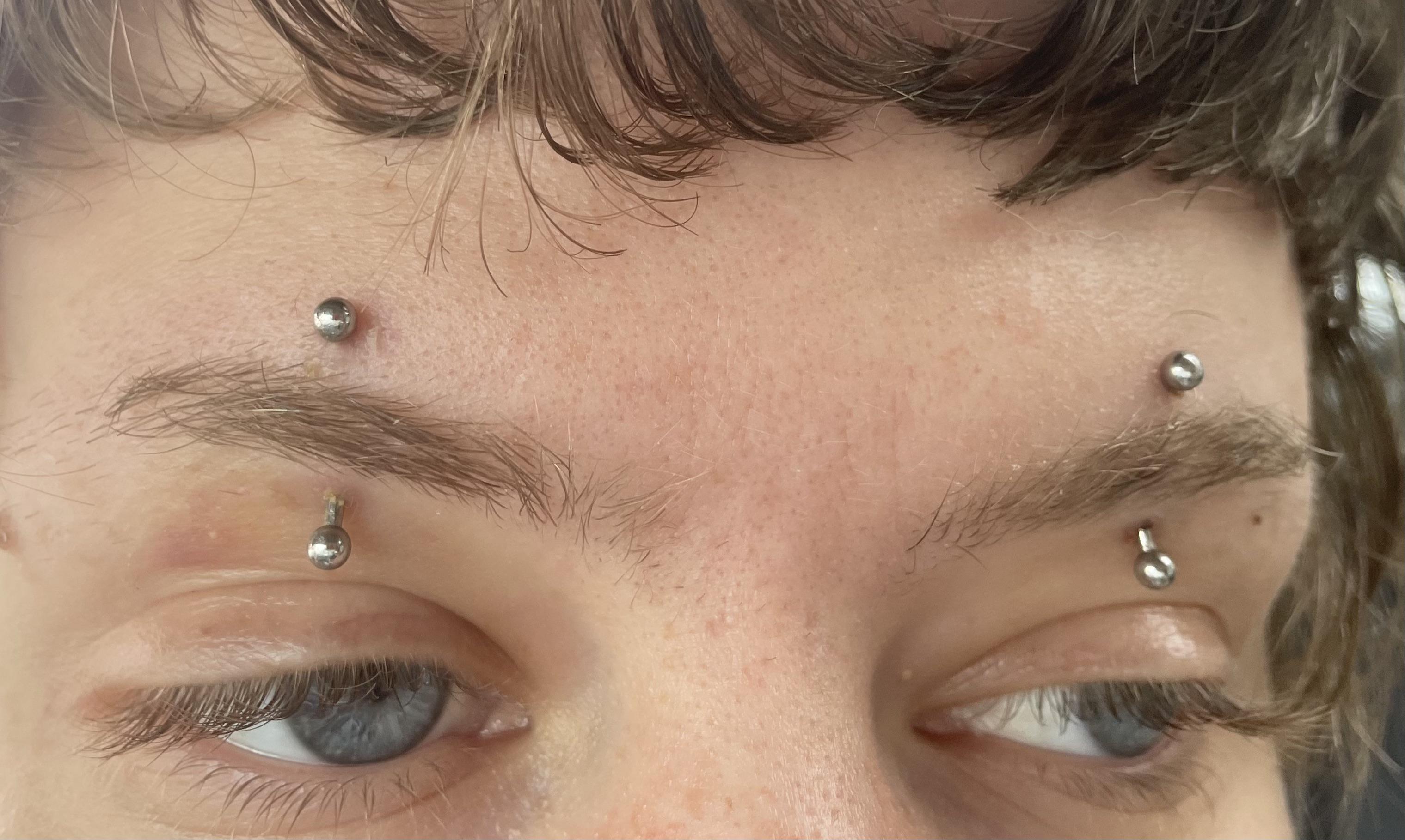 New mideyebrow piercings have been red for about a week and half. Do
