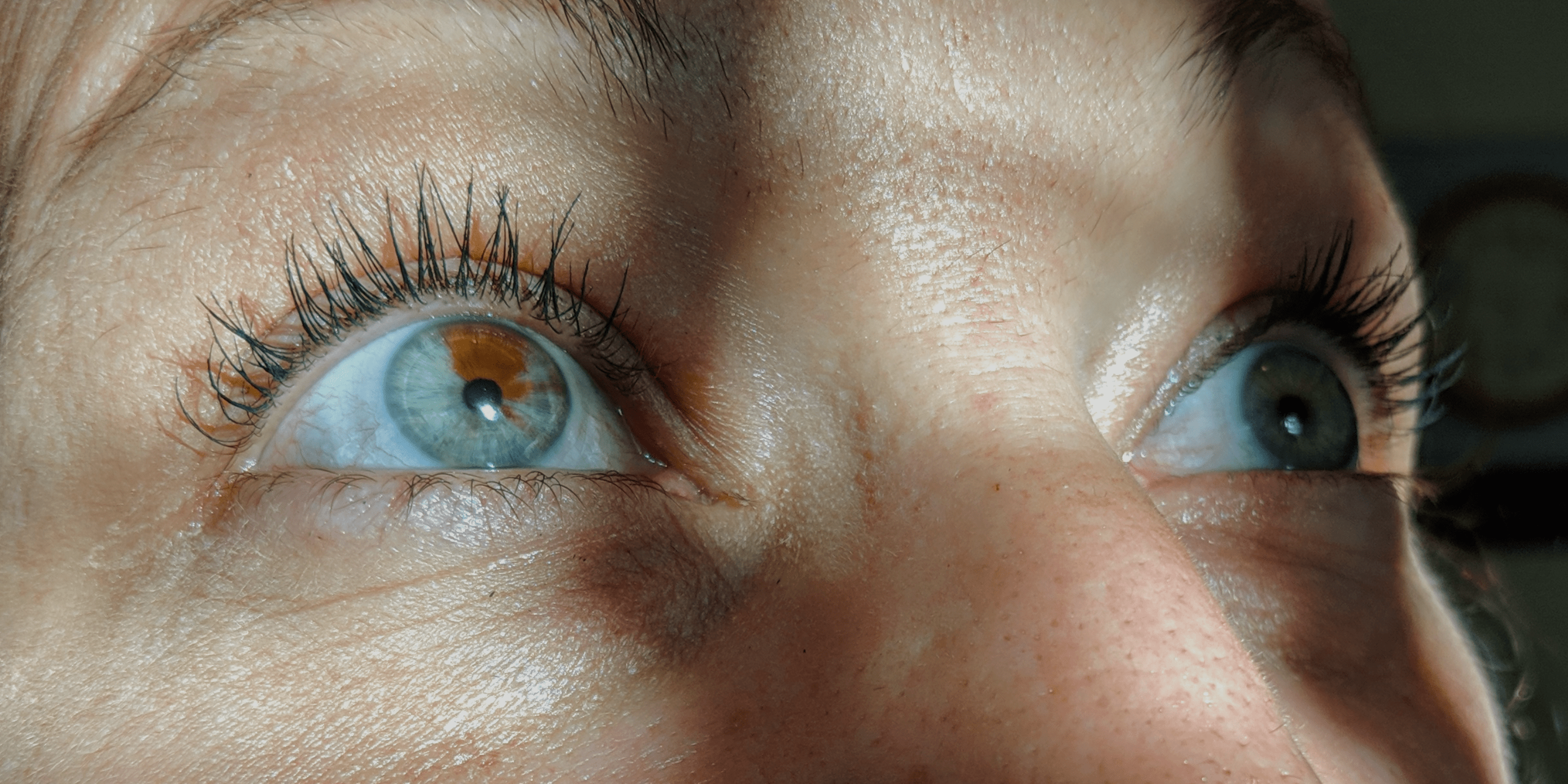 My friend's mother has gray and green eyes with a birth mark in one of