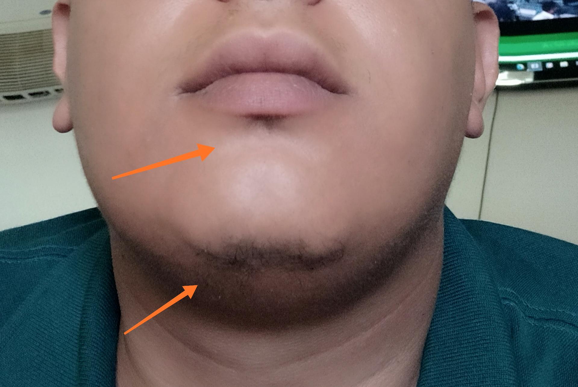 I'm 26 and that's all the facial hair i have ( i have no body hair