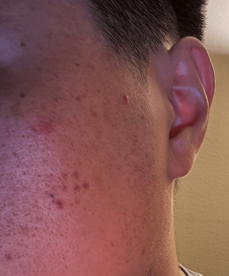 Anyone else have this weird cluster problem? Keeps coming back