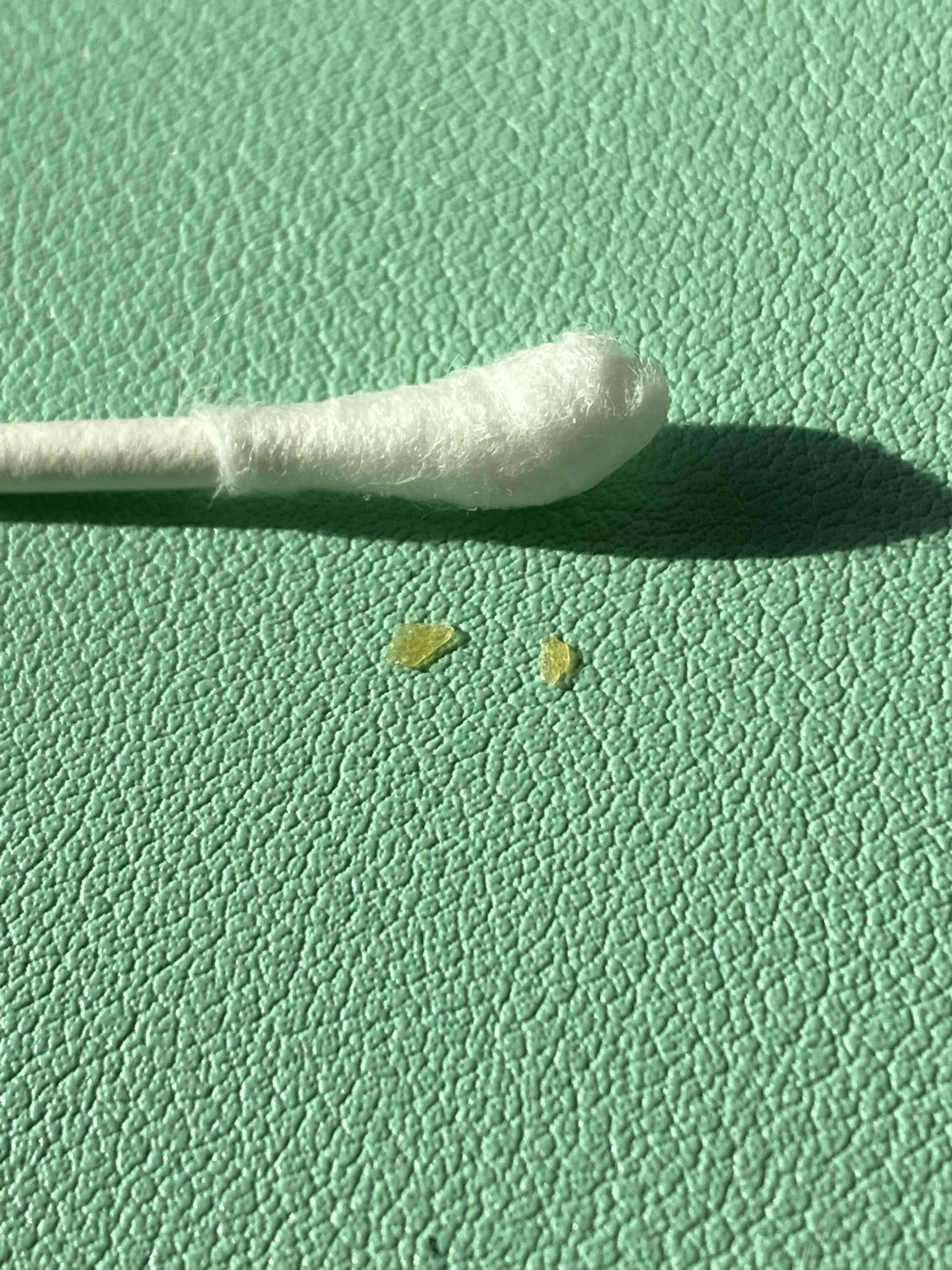More Dry Flakes From My Right Ear r/earwax