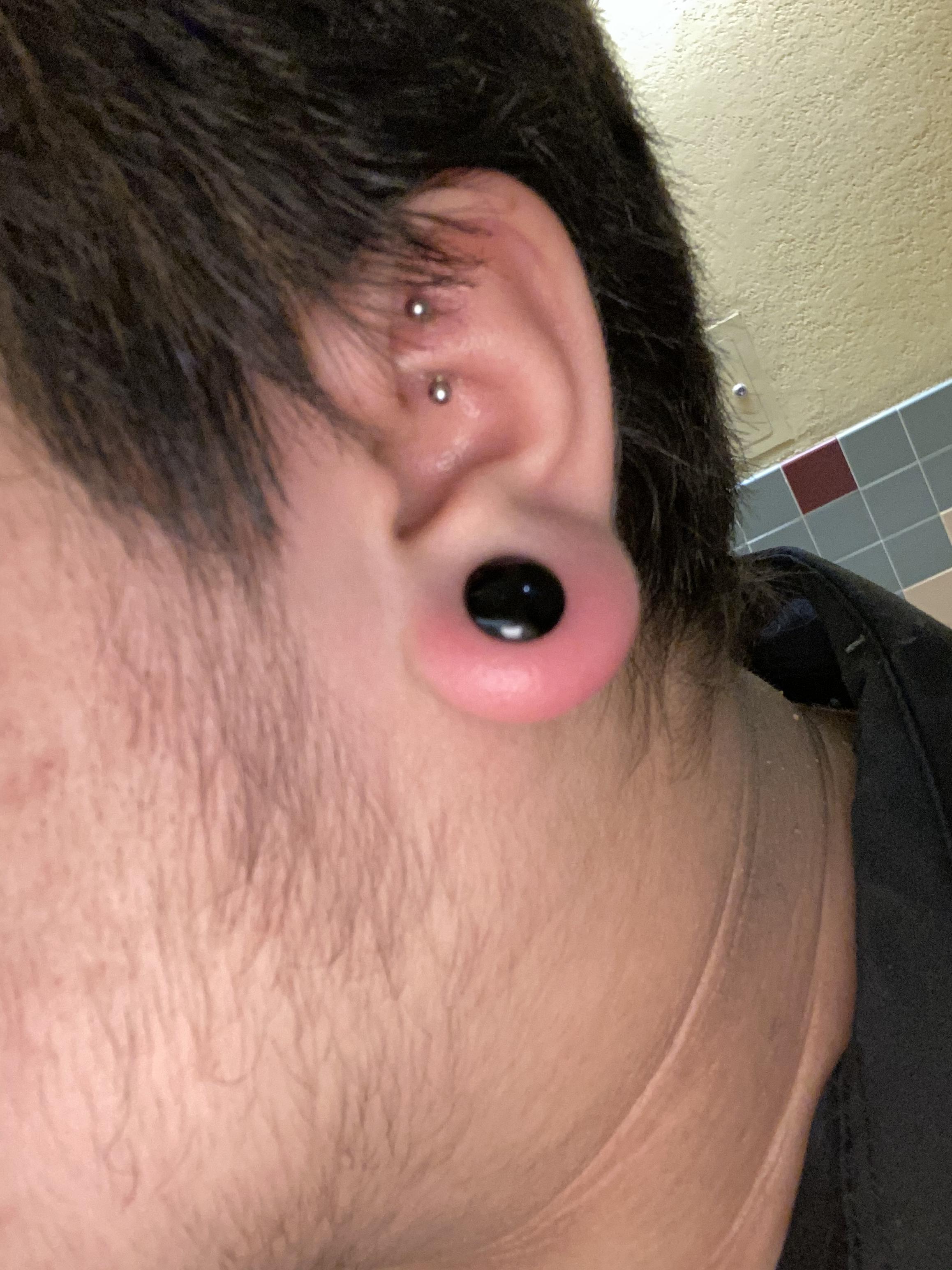 Infected Gauges