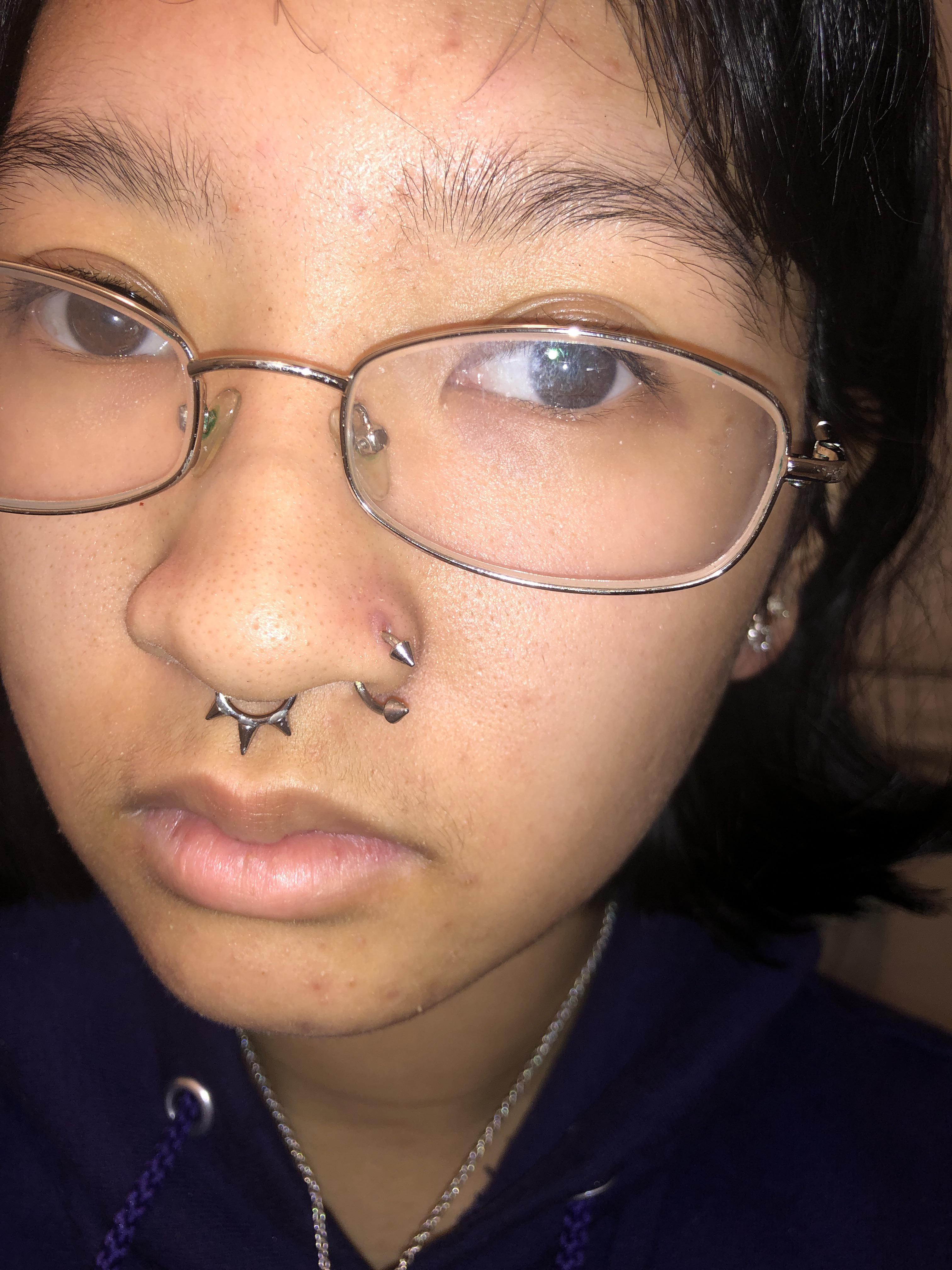 how do i get rid of this piercing bump? its been a month, ive done