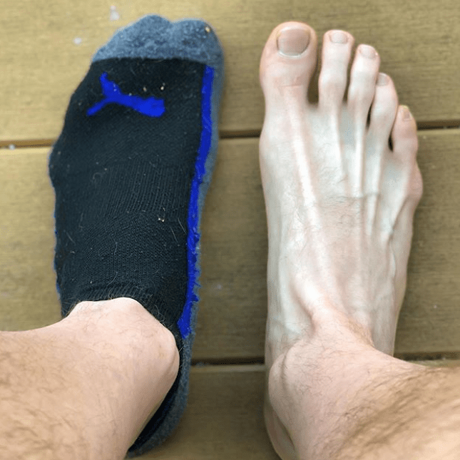 Sock On/Off r/Bettertobebarefoot