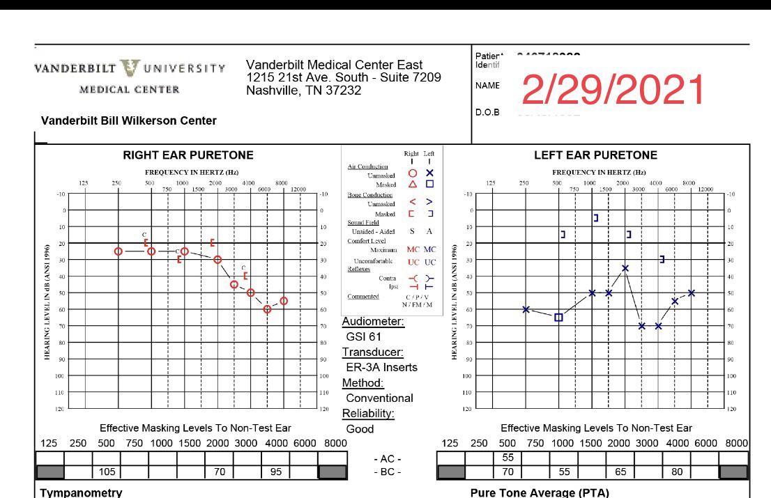 VA Audiologists audiology