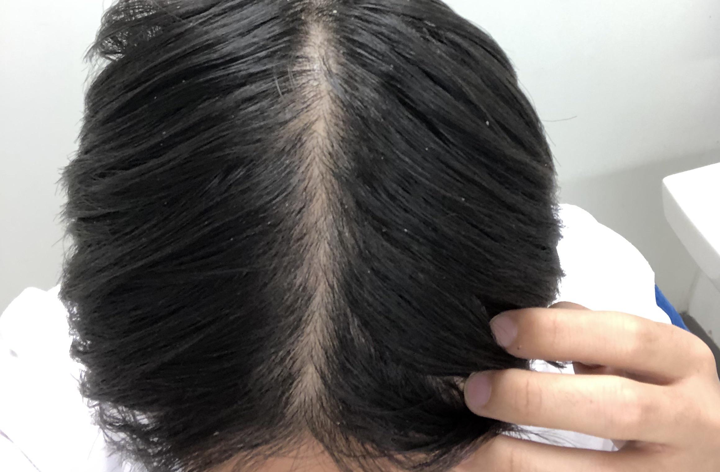 Hey guys just a question. Does my hair part look normal or does it look like it’s thinning ? r