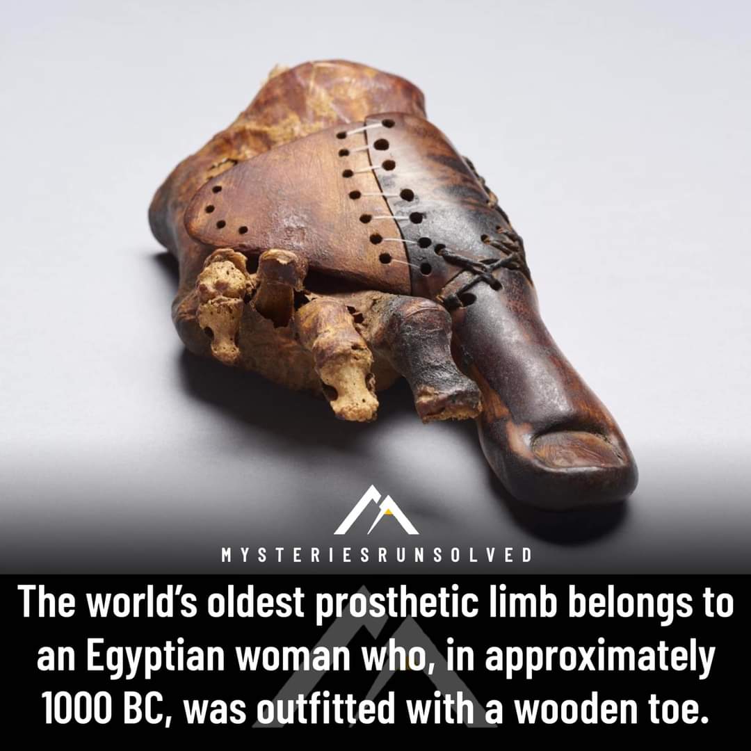 Prosthetic limb from history r/ancienthistory