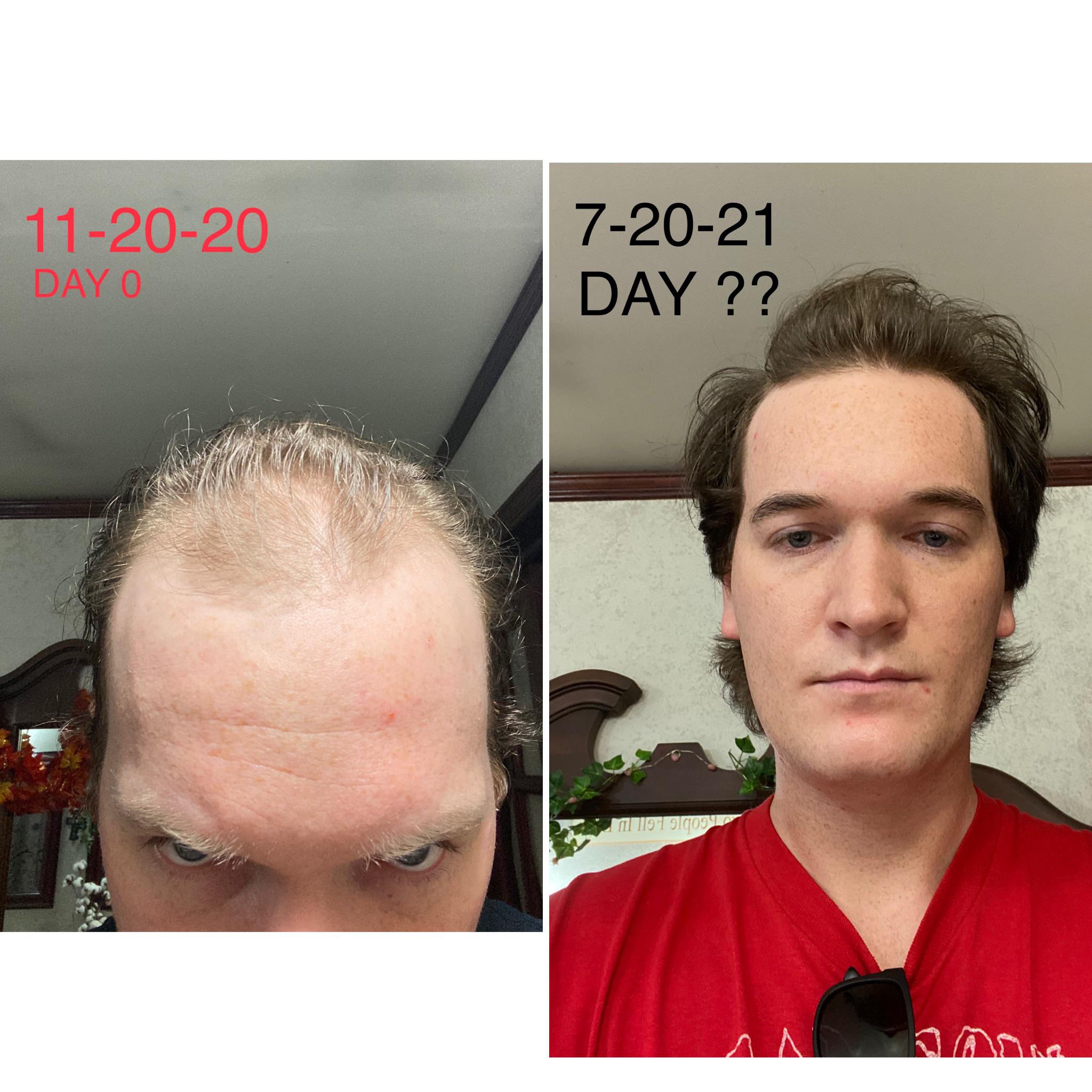 Pale ghoul here starting to notice his receding hairline and looking