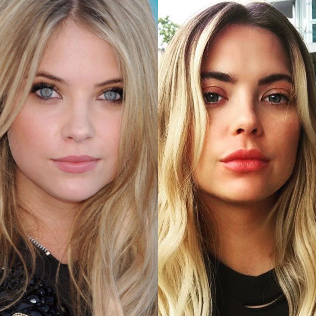 Ashley Benson Nose Job Before And After