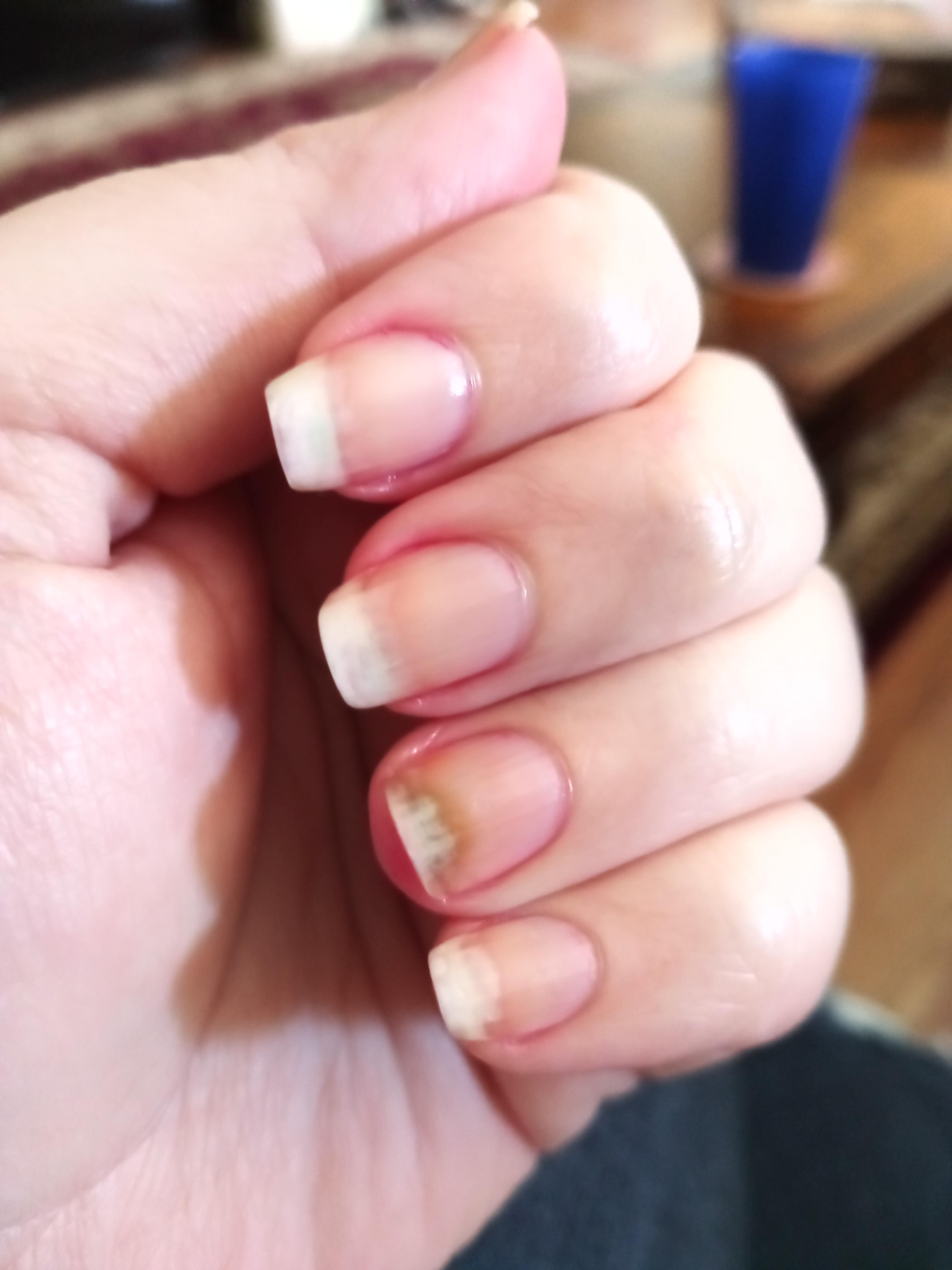 Why is my ring nail green?! It broke from the length of the others and