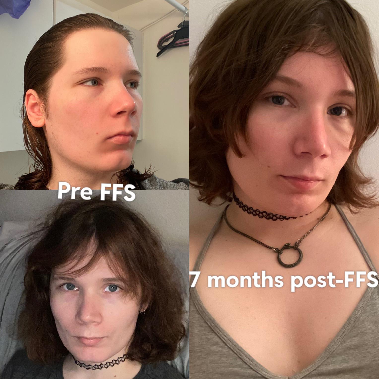 Reddit Transtimelines Truth or Fiction