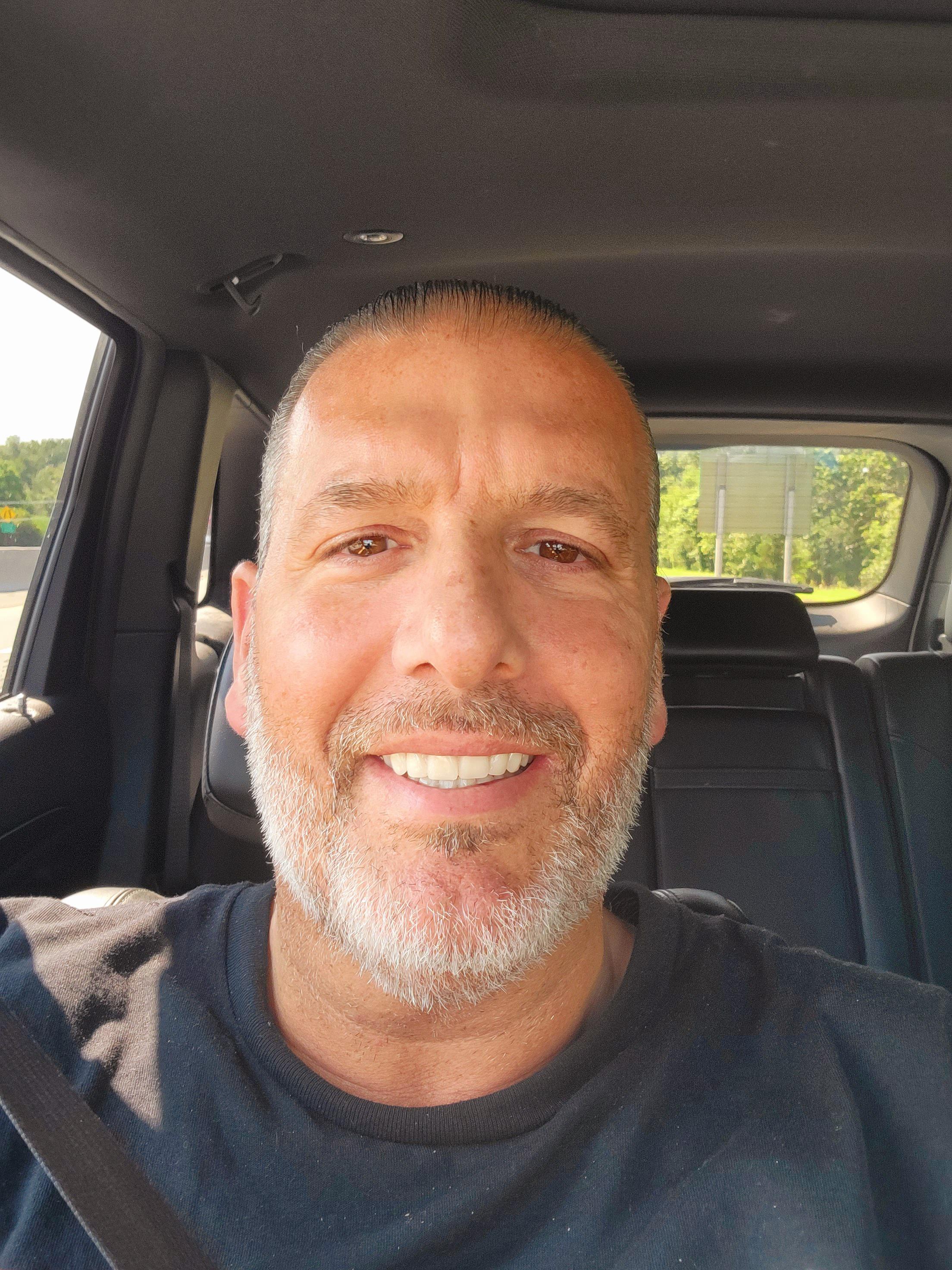 ADHESIVES r/dentures