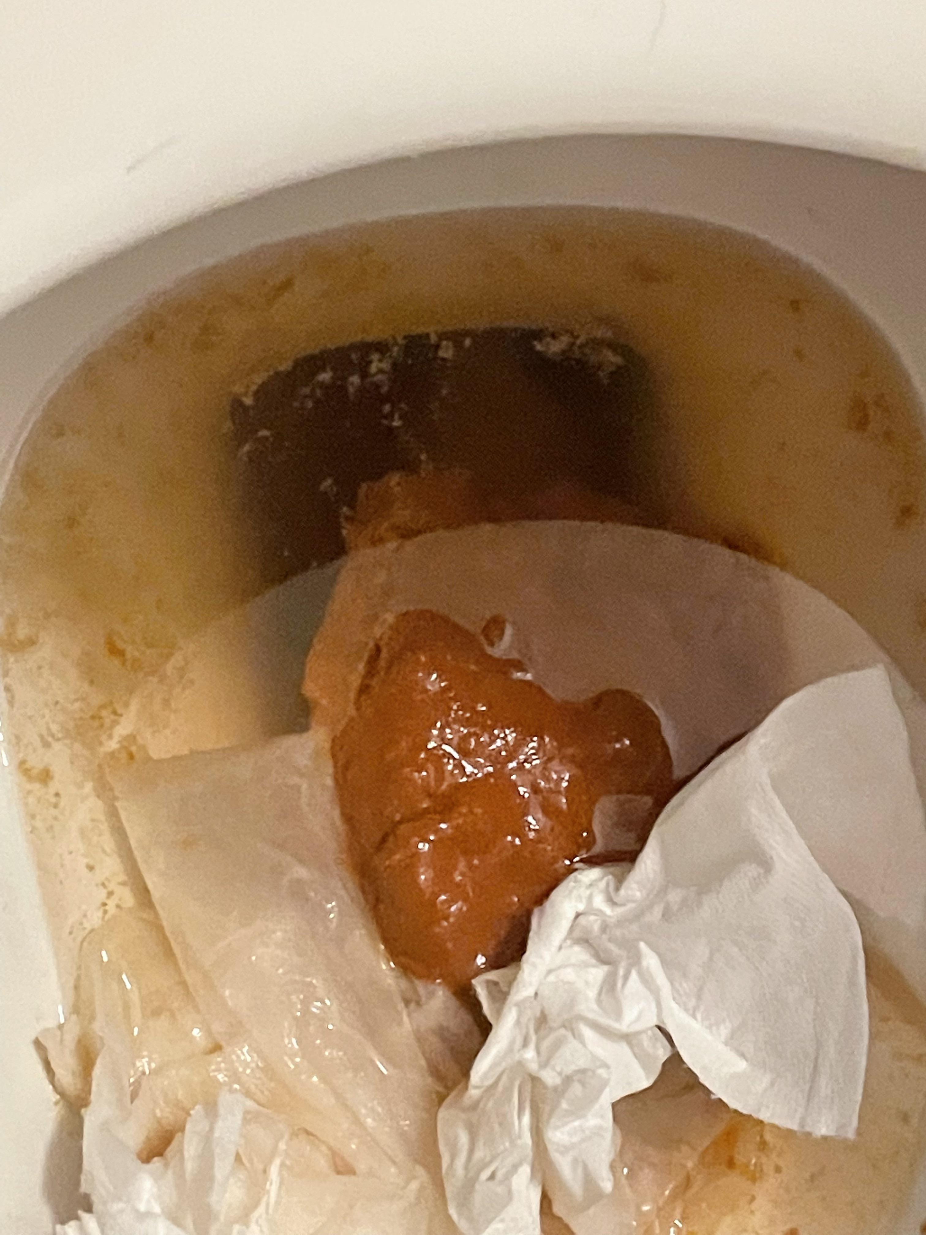 The result of eating half a bag of hot cheetos and it being my time of