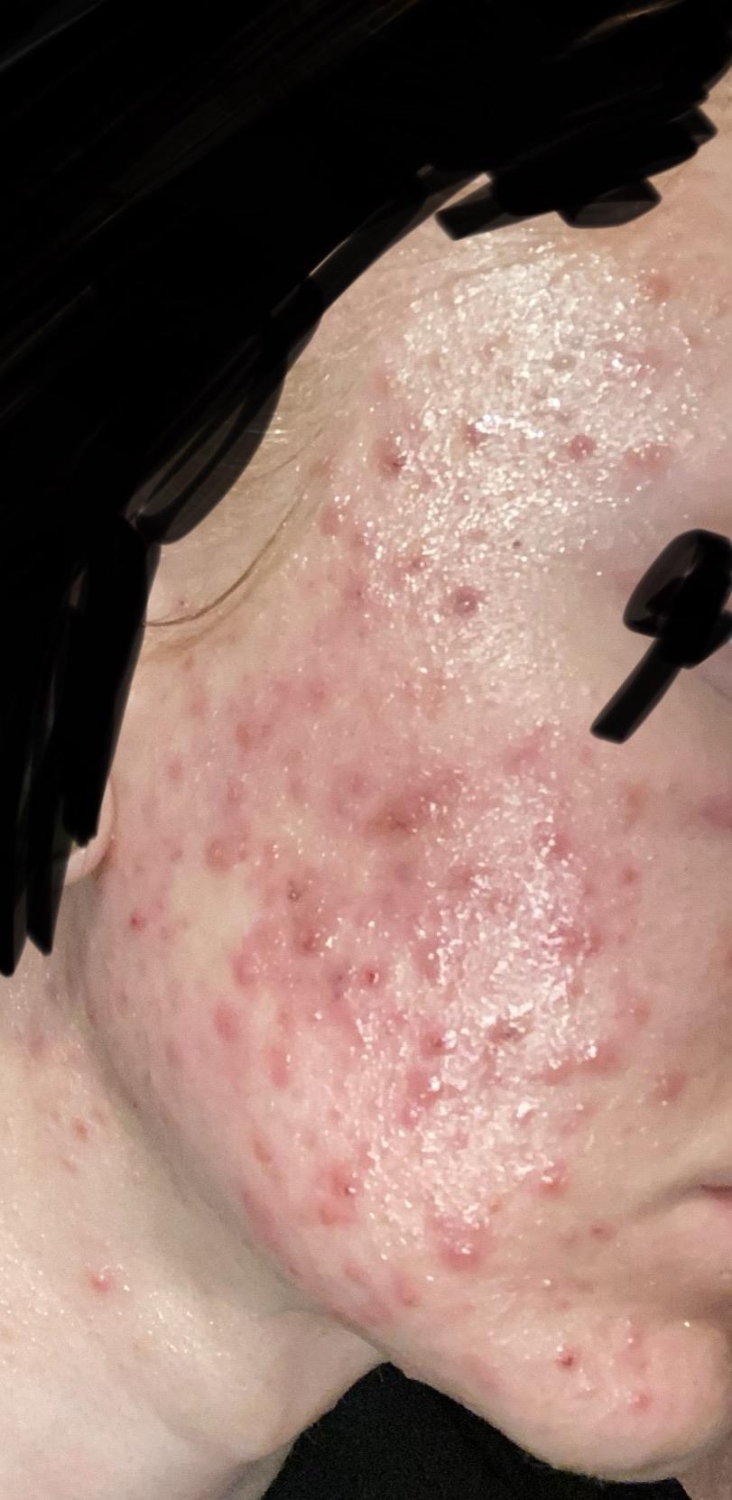 Please help doctors can’t figure this out. by physical