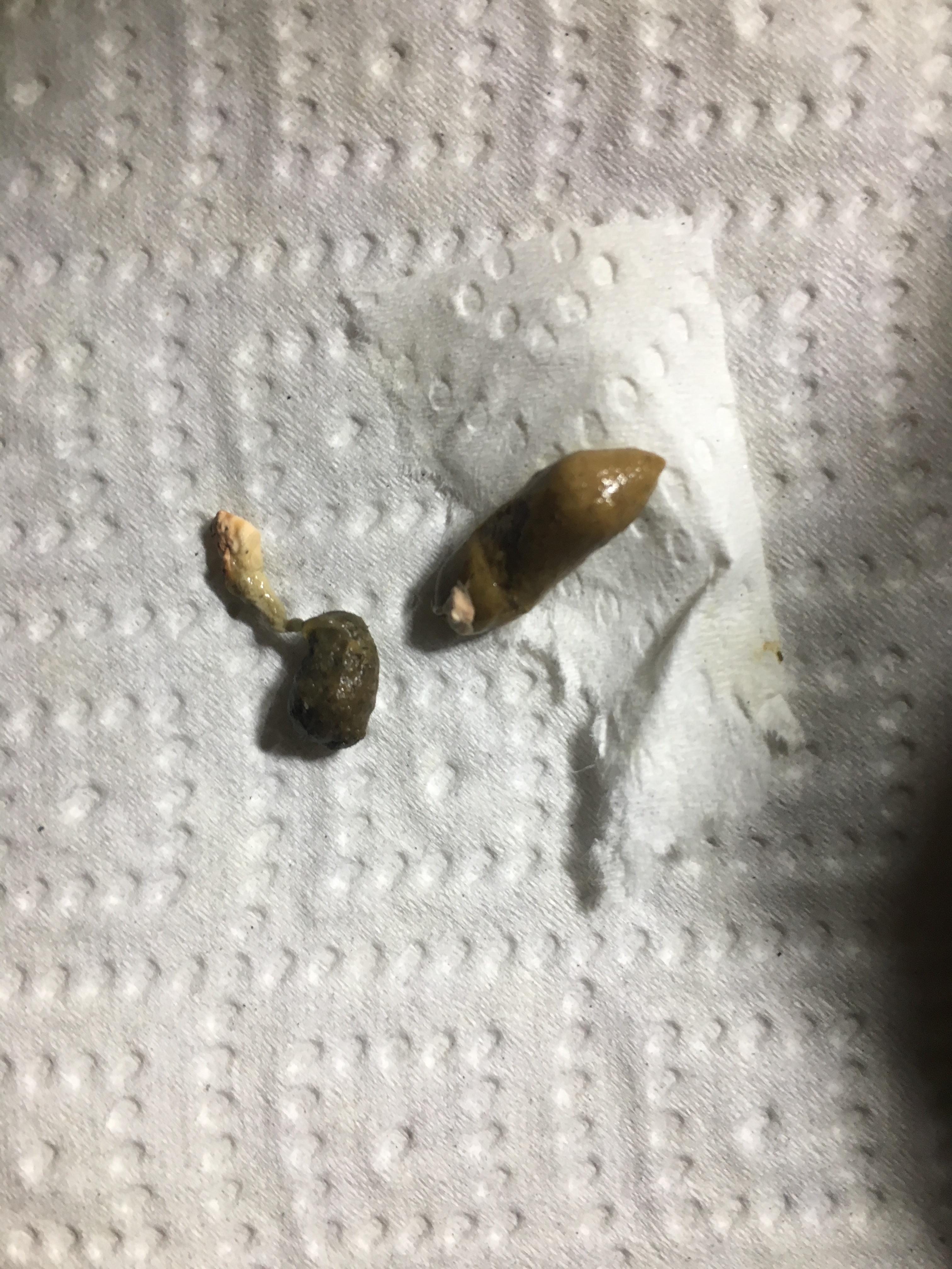 Question does this poop look “healthy”? From my gargoyle gecko, first