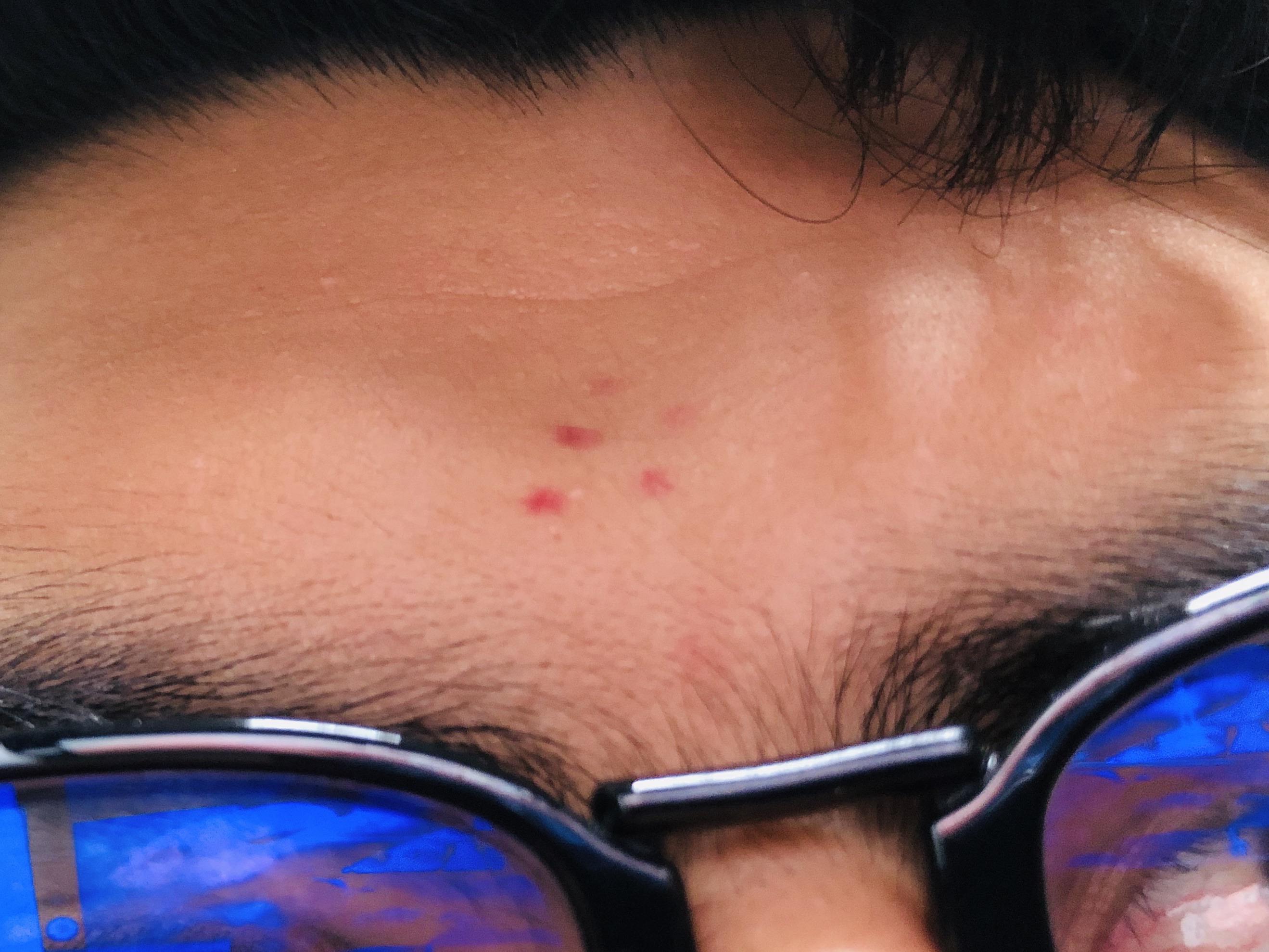 Woke up with these dots on my face? Any idea what they are? r