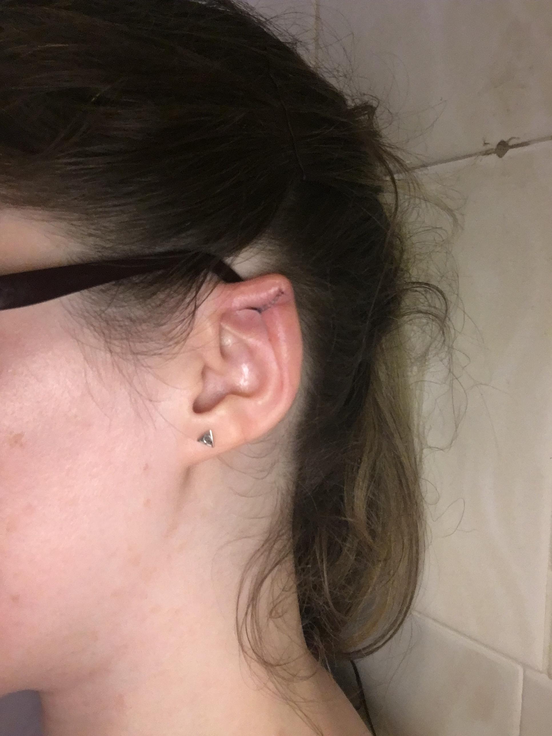 Reddit Dive into anything