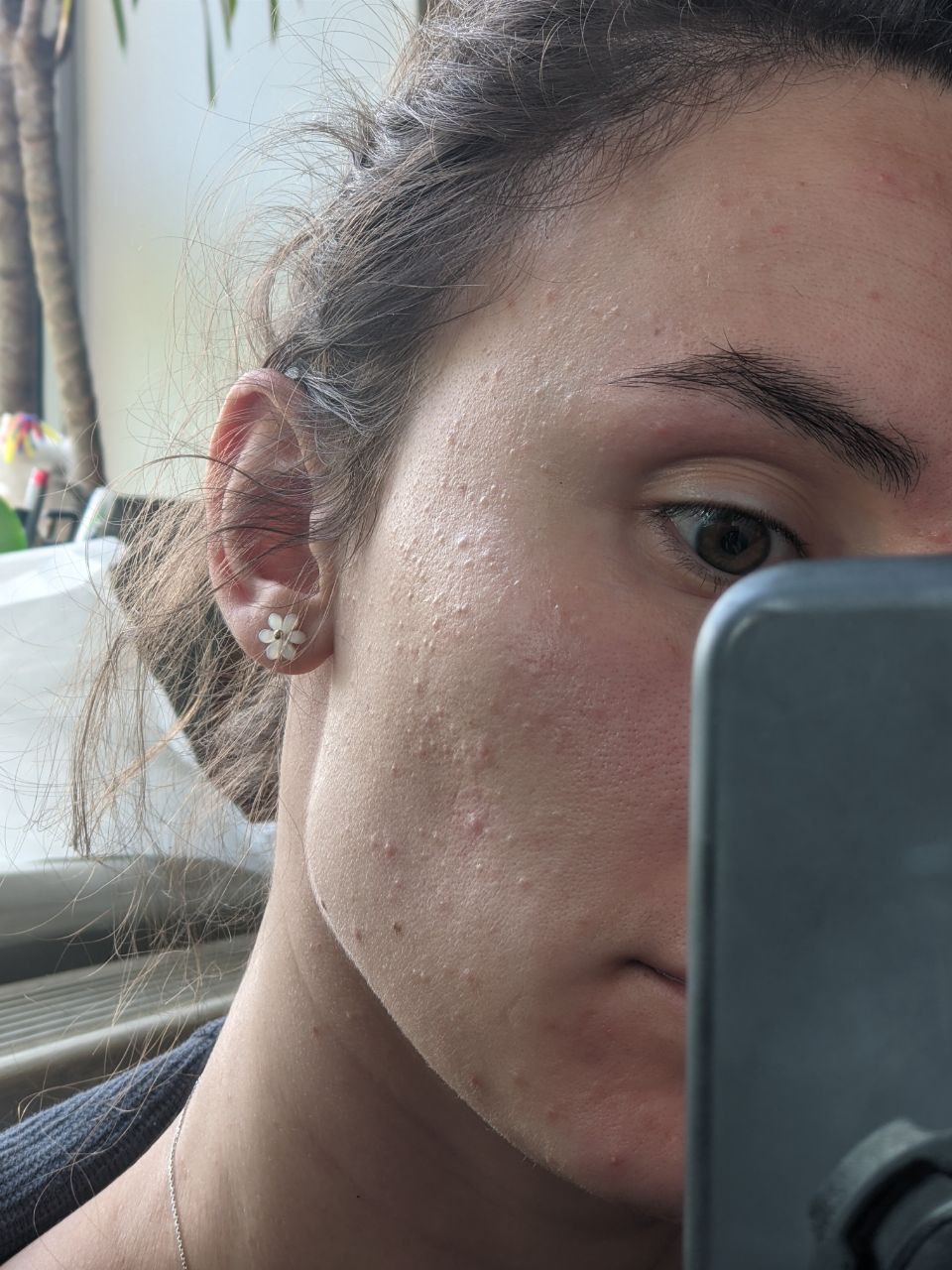 Any advice on what's happening in here? it appeared a few weeks ago and