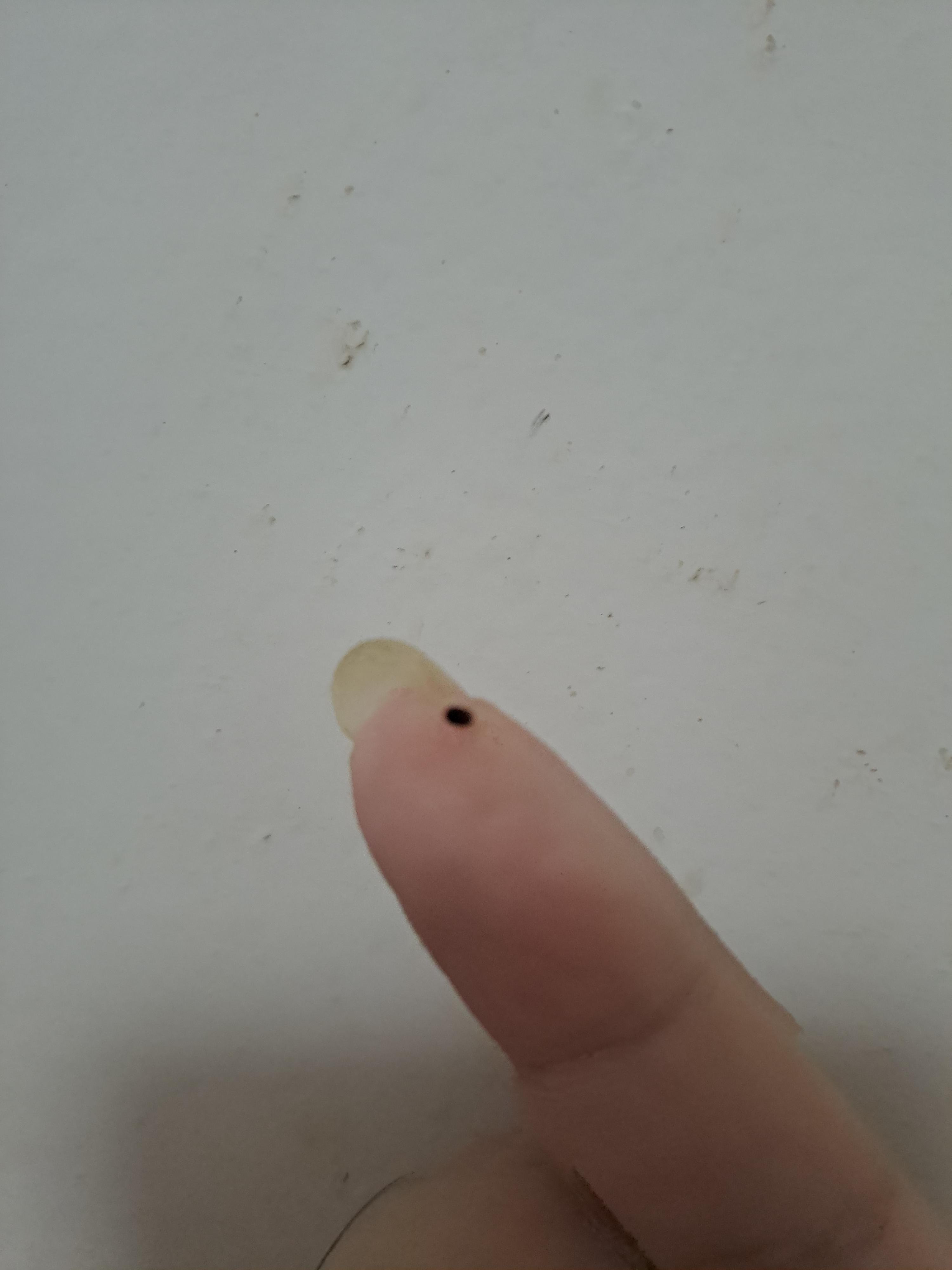 does anyone know if this is head lice? a bunch of this fell out of my