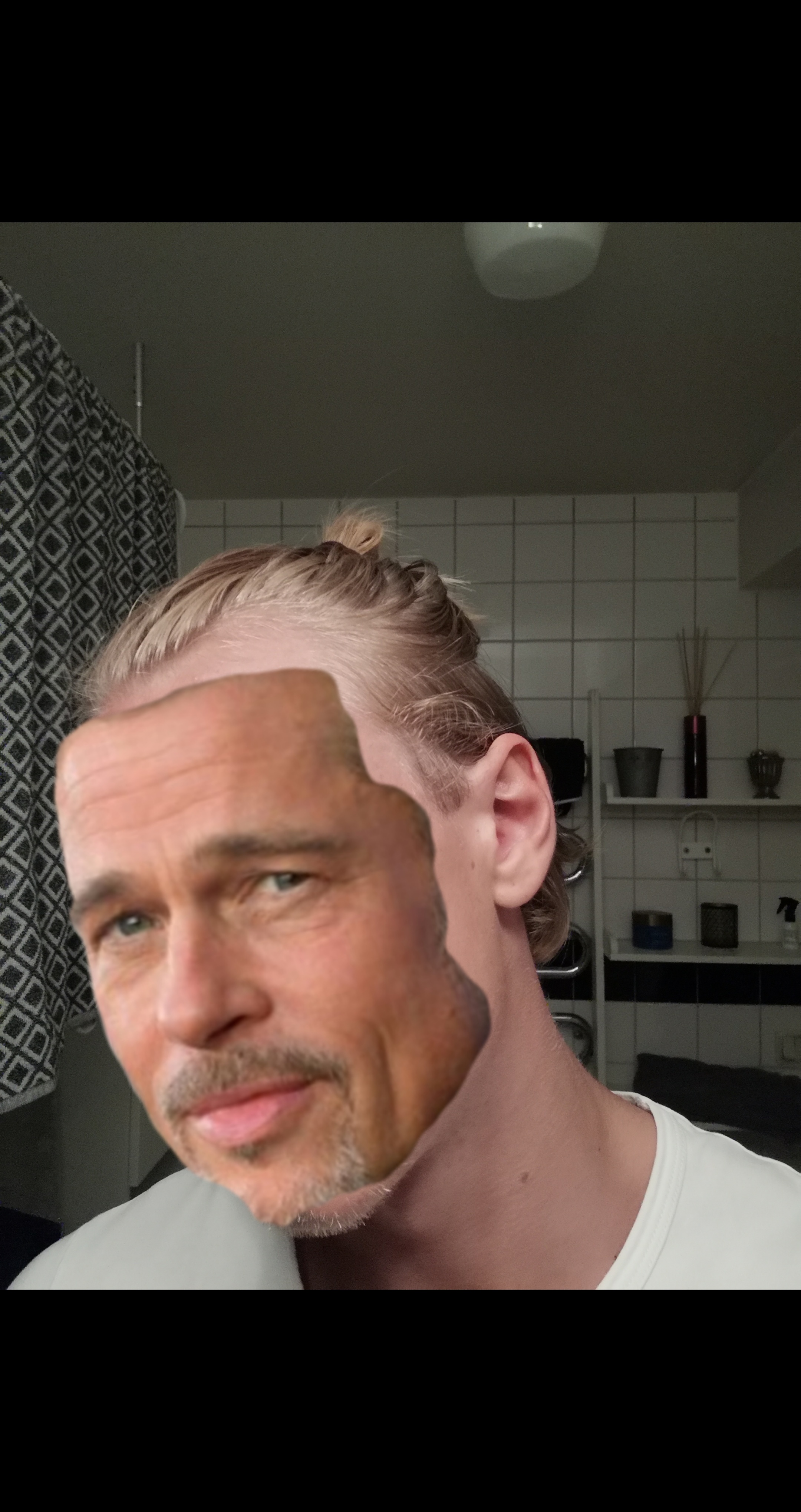 White balls in husband's (m24) hair but no itch or normal signs of