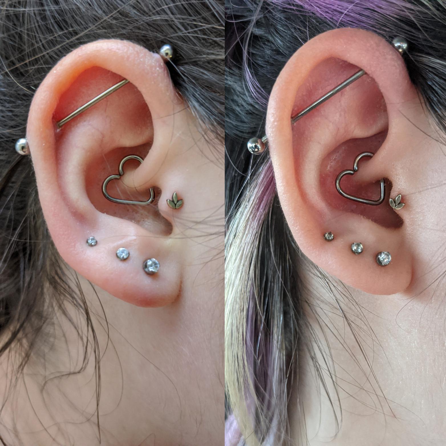Should I be worried about migration for my tragus? I've gone twice to