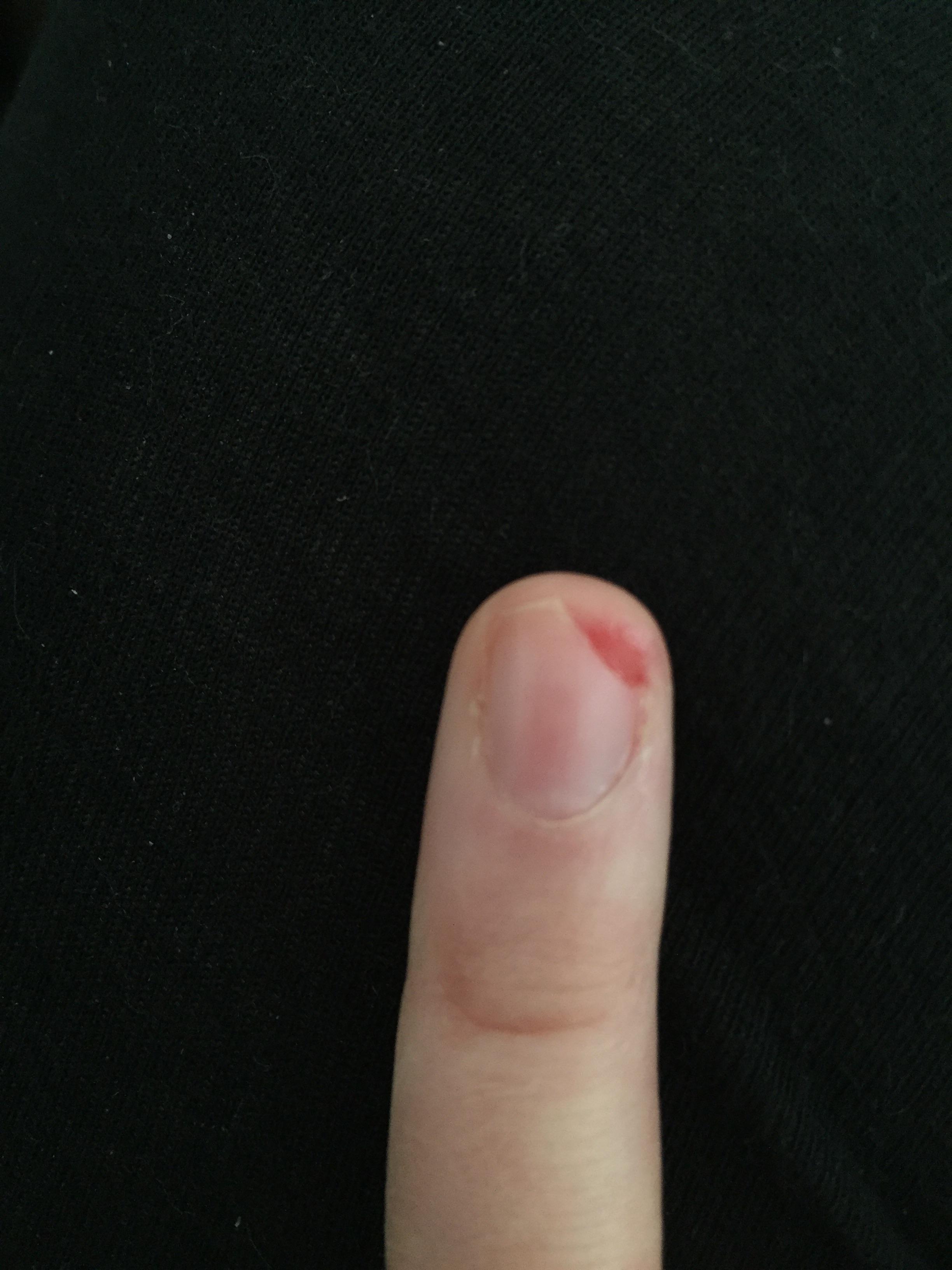 Help! I normally don’t put much thought into my nails just keep them