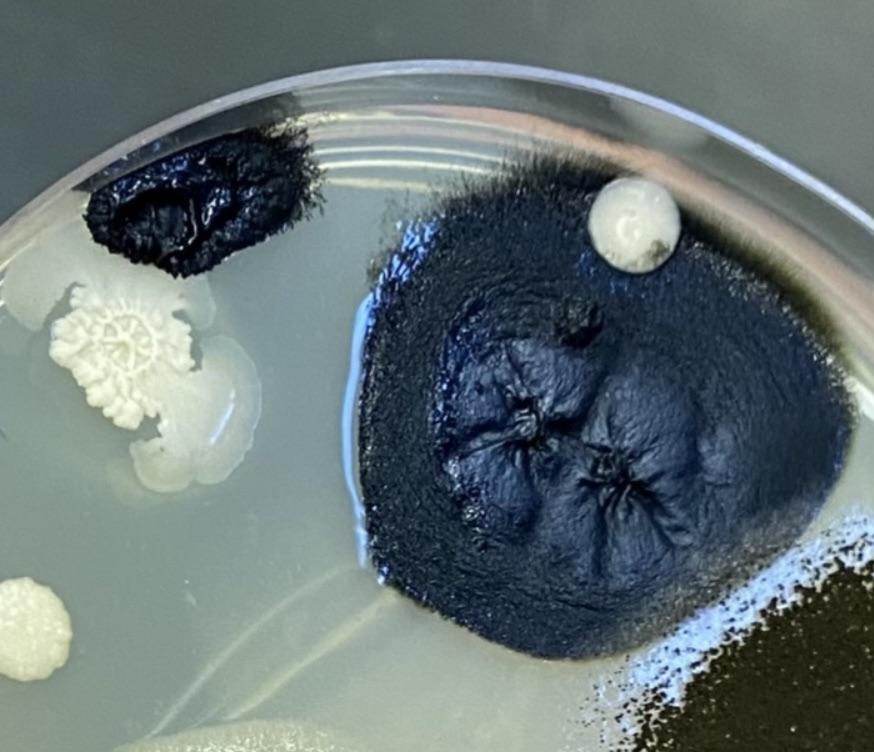 Albums 92+ Images What Does Black Mold Look Like In A Petri Dish Stunning