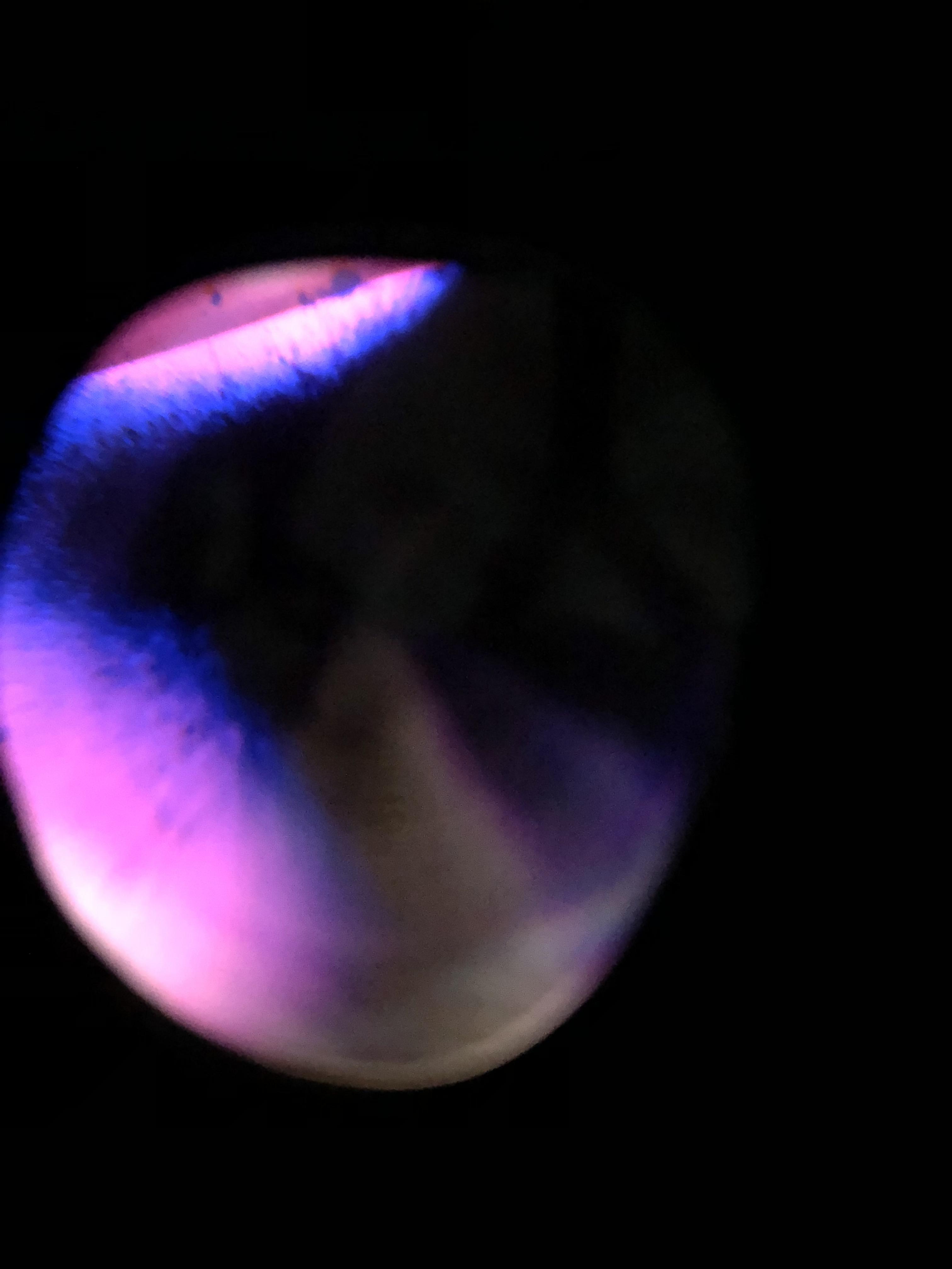 So this big purple black blotch just appeared need diagnosis. It takes