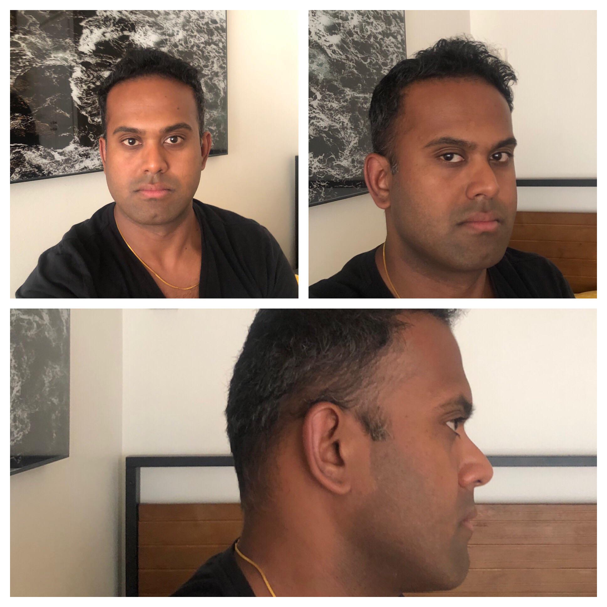 Could jaw surgery improve my aesthetics ? Went to my orthodontist to